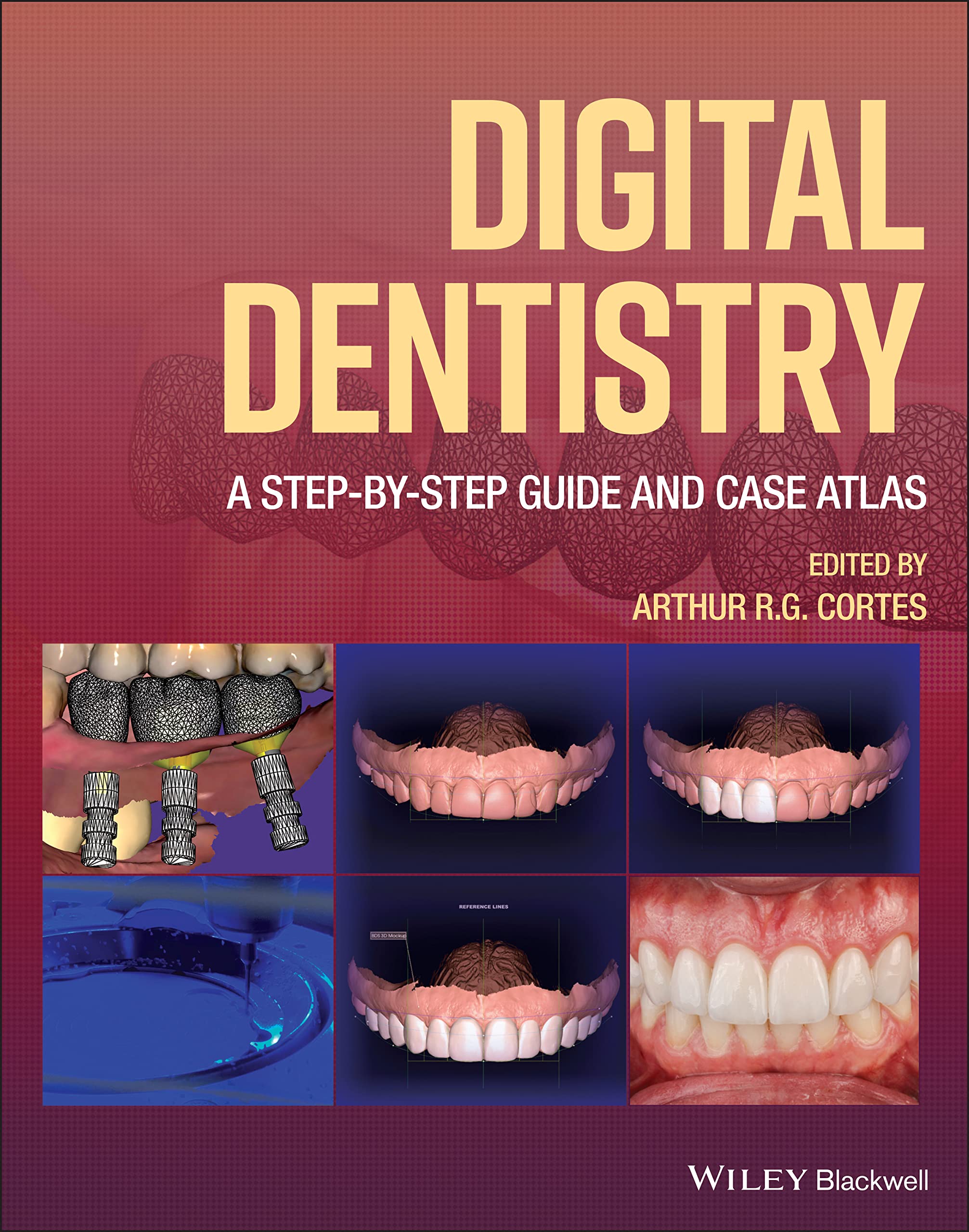 Digital Dentistry: A Step-​by-​step Guide and Case Atlas