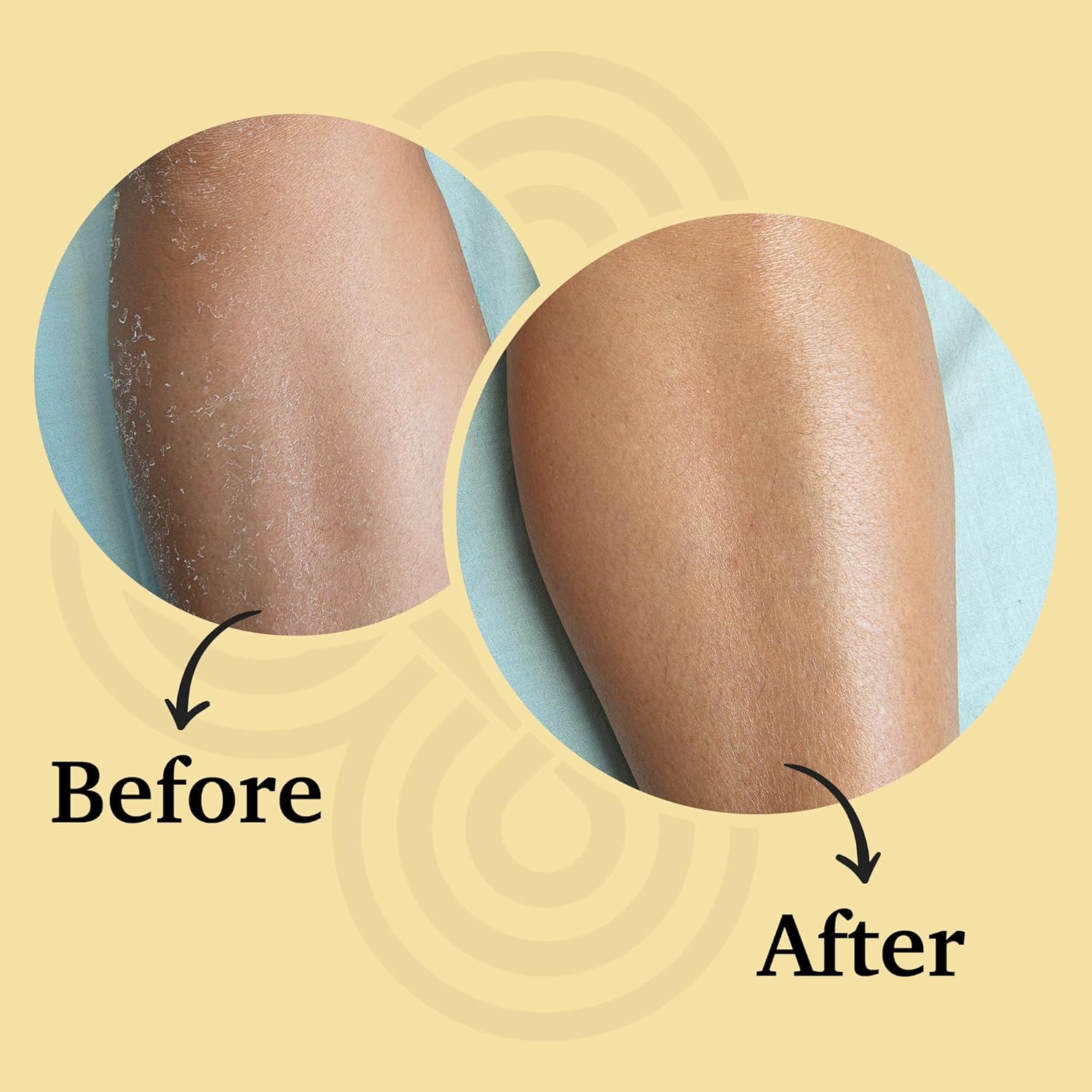 The Melting Balm - Tallow + Rosehip Oil Moisture Stick for Face & Body | 100% Grass Fed Tallow Balm | Clean Solid Moisturizer for Dry Sensitive Skin | Instant Relief & Continuous Recovery | 2.5 oz