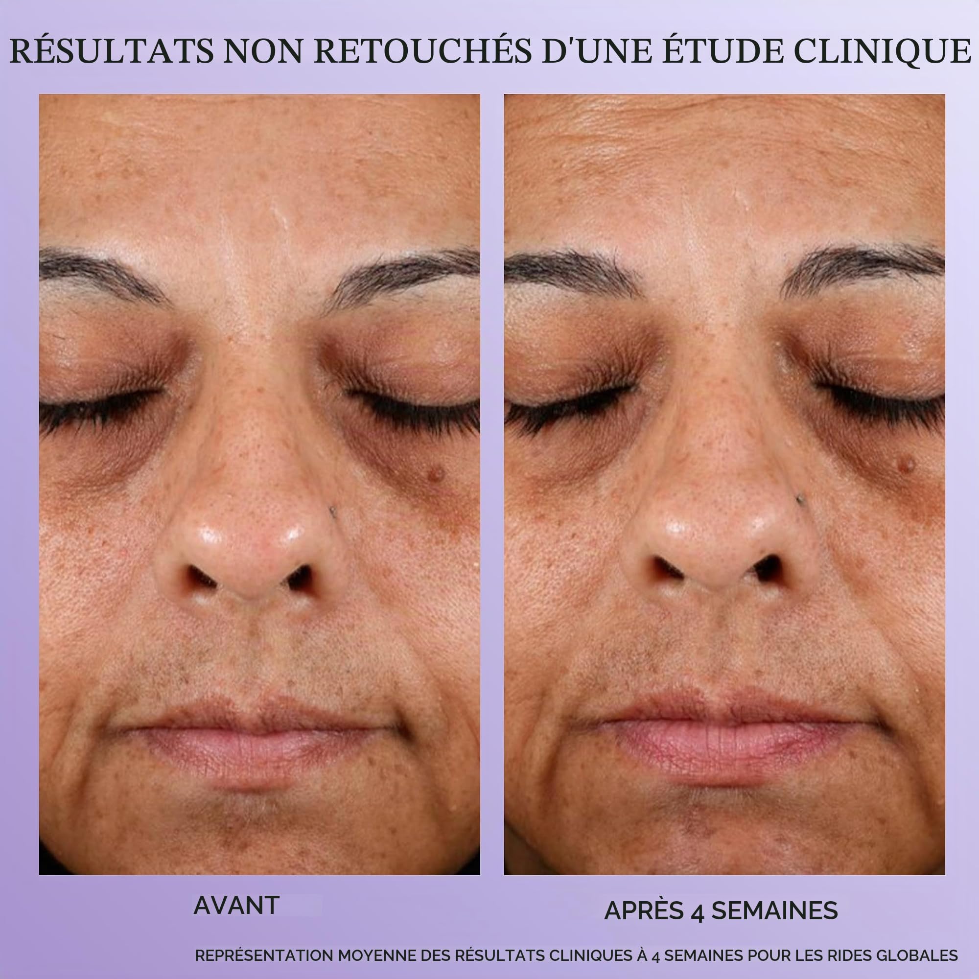 Lancôme - Rénergie H.P.N. 300-Peptide Crème Anti-Âge Haute Performance Rechargeable - Soin Visage, Cou et Front Raffermissant Anti-Rides et Anti-Taches - Haute Sensorialité - Fabriqué en France