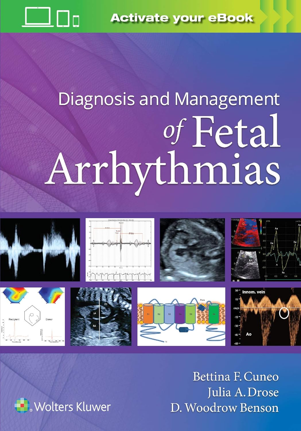 Diagnosis and Management of Fetal Arrhythmias      Illustrated Edition