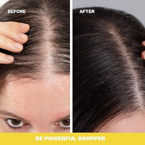 Miniatura 8 de Extracto de raíz de jengibre  Gotas estimulantes del crecimiento y control de la pérdida de cabello  Serum Vegan Energizante Elixir para el cabello