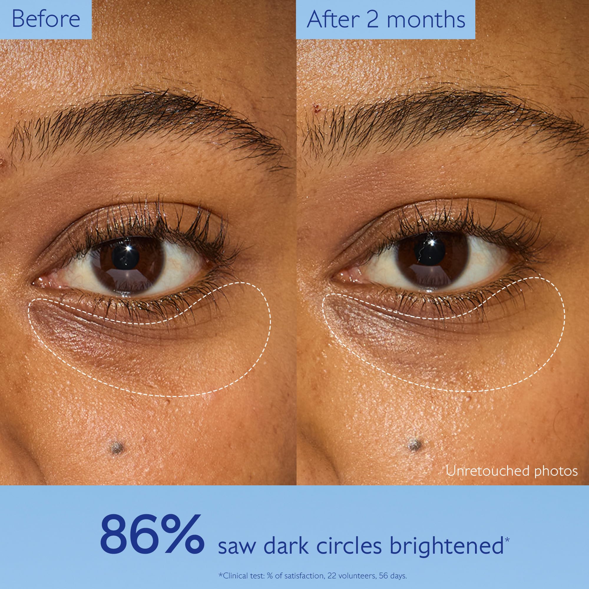 Caudalie Vinoperfect Dark Circle Brightening Caffeine Eye Cream, 15 mL