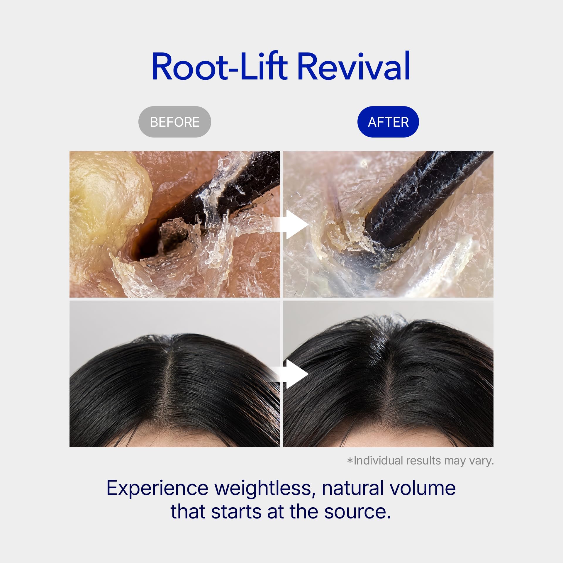 スカルプ再生ケア頭皮ケア用スピキュールHairlopecia定価¥35,000 Amazon | ViveLab スカルプマイクロニードルセラム – K-beauty 育毛