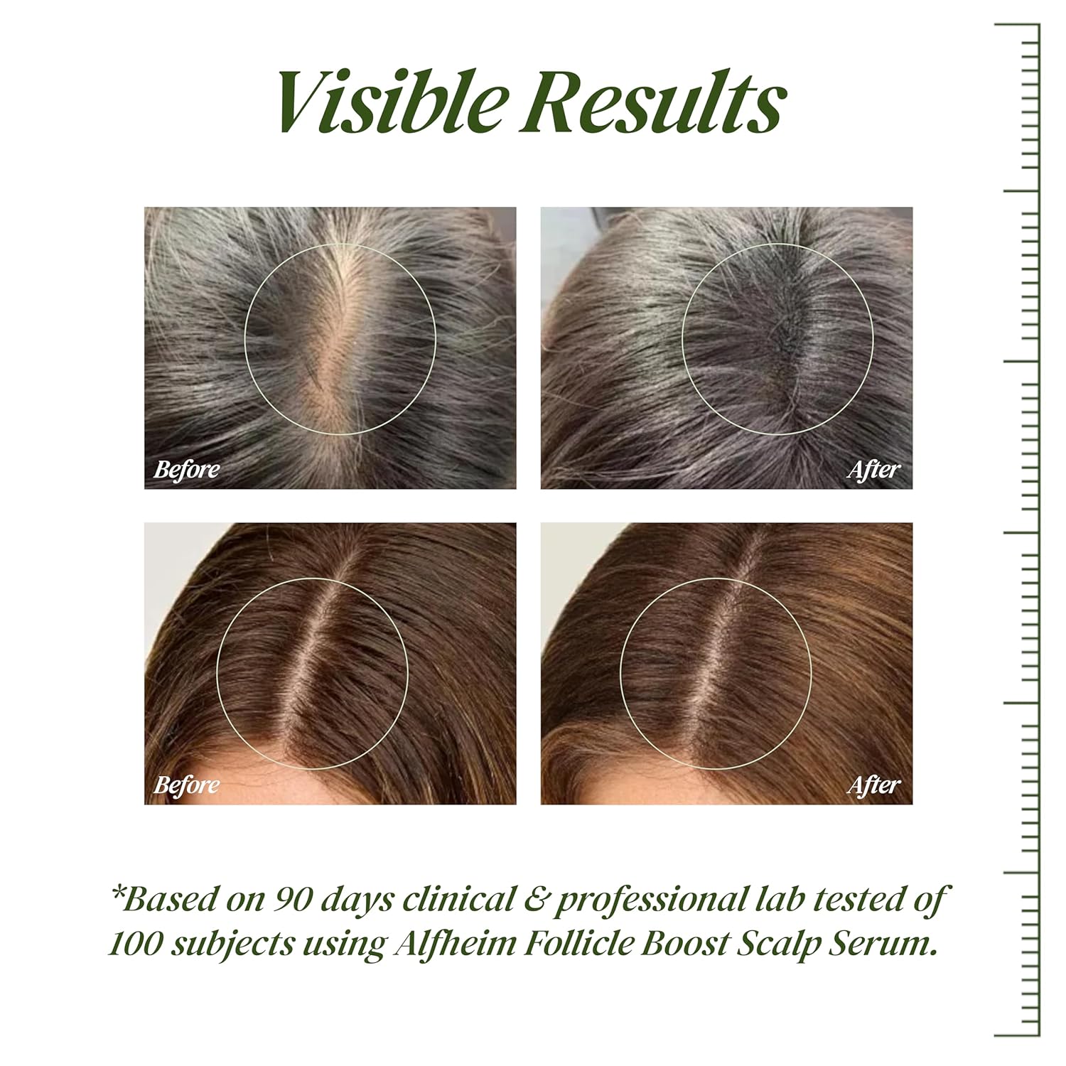ALFHEIM Saw Palmetto Scalp Serum for Boost Follicle - Infused With Caffeine, Biotin for Thicker Hair - Balance Scalp, Rejuvenate Hair Follicles & Improve Hair Density - 1.69 fl oz + Serum Applicator - Image 2