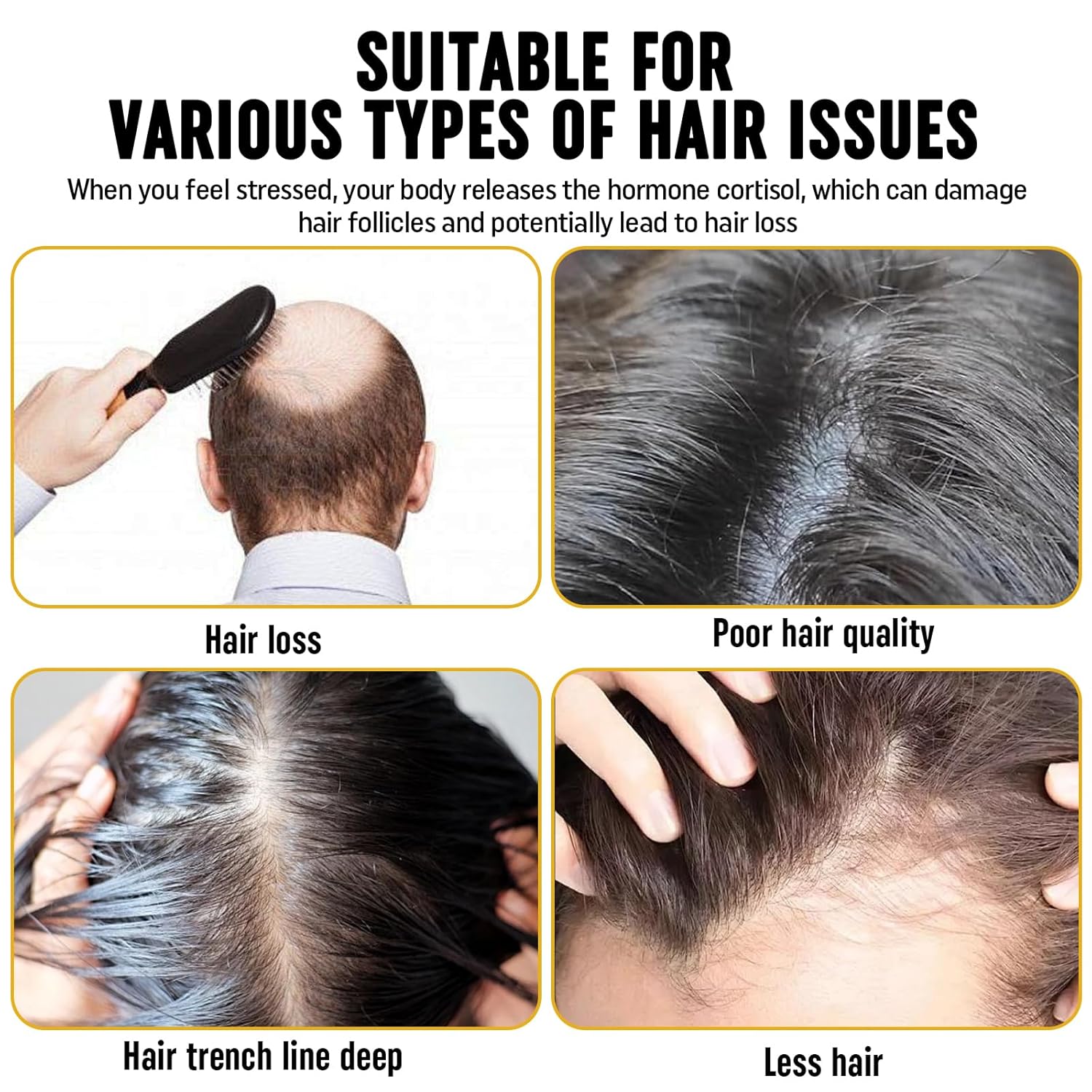 2Pcs Root Activator Shampoo - Hair Growth Root Activator Shampoo for Men and Women - Natural Formula for Hair Loss and Thinning Hair - Image 4