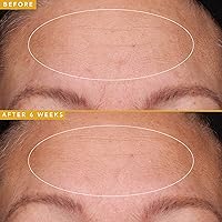 Vista 3 de Farmacy Hyaluronic Acid Serum for Face - Filling Good Face Serum with Vegan Collagen Peptides - Helps Smooth Fine Lines + Wrinkles - Hydrating