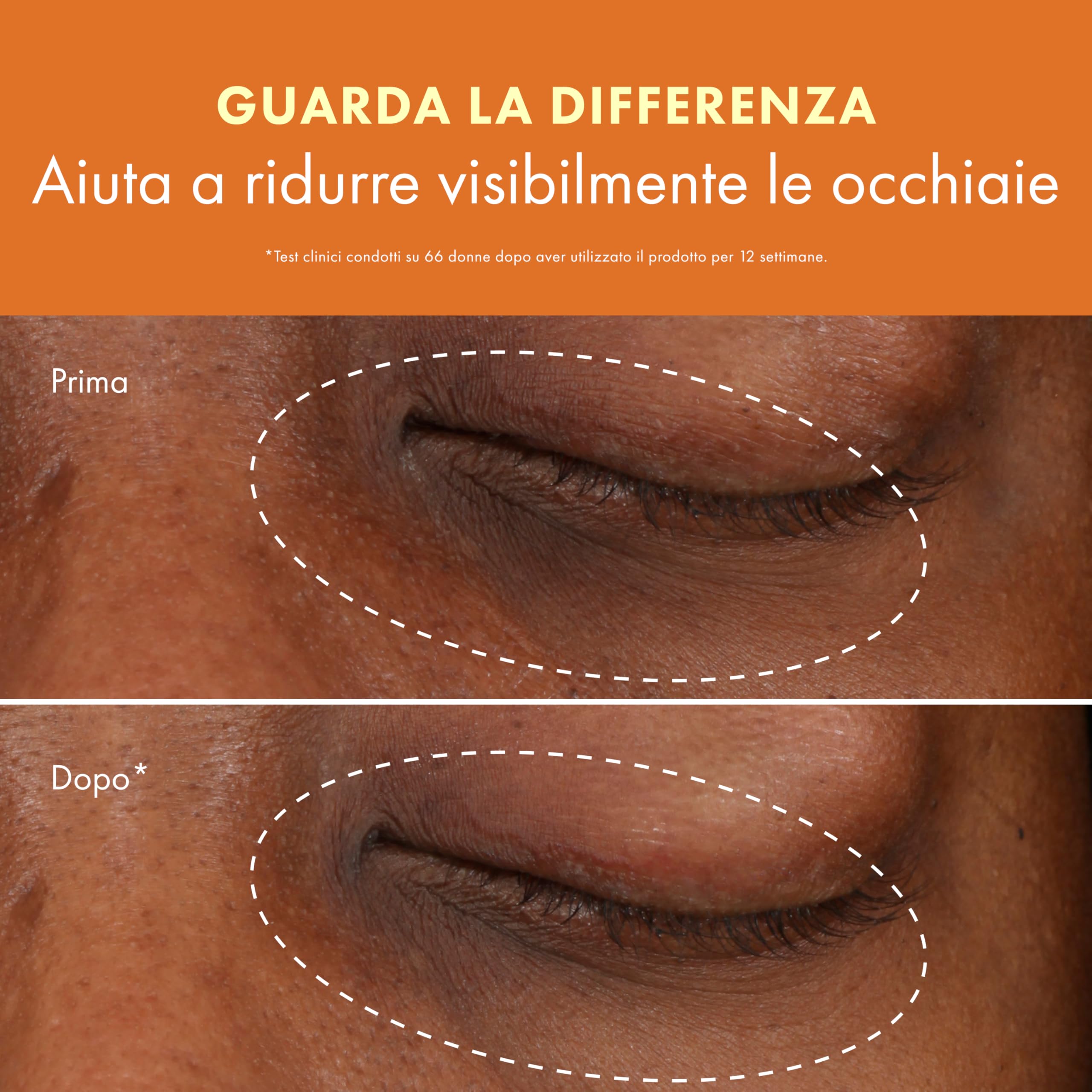 Origins GinZing Crema Occhi Illuminante con Vitamina C & Niacinamide | Riduce visibilmente le occhiaie