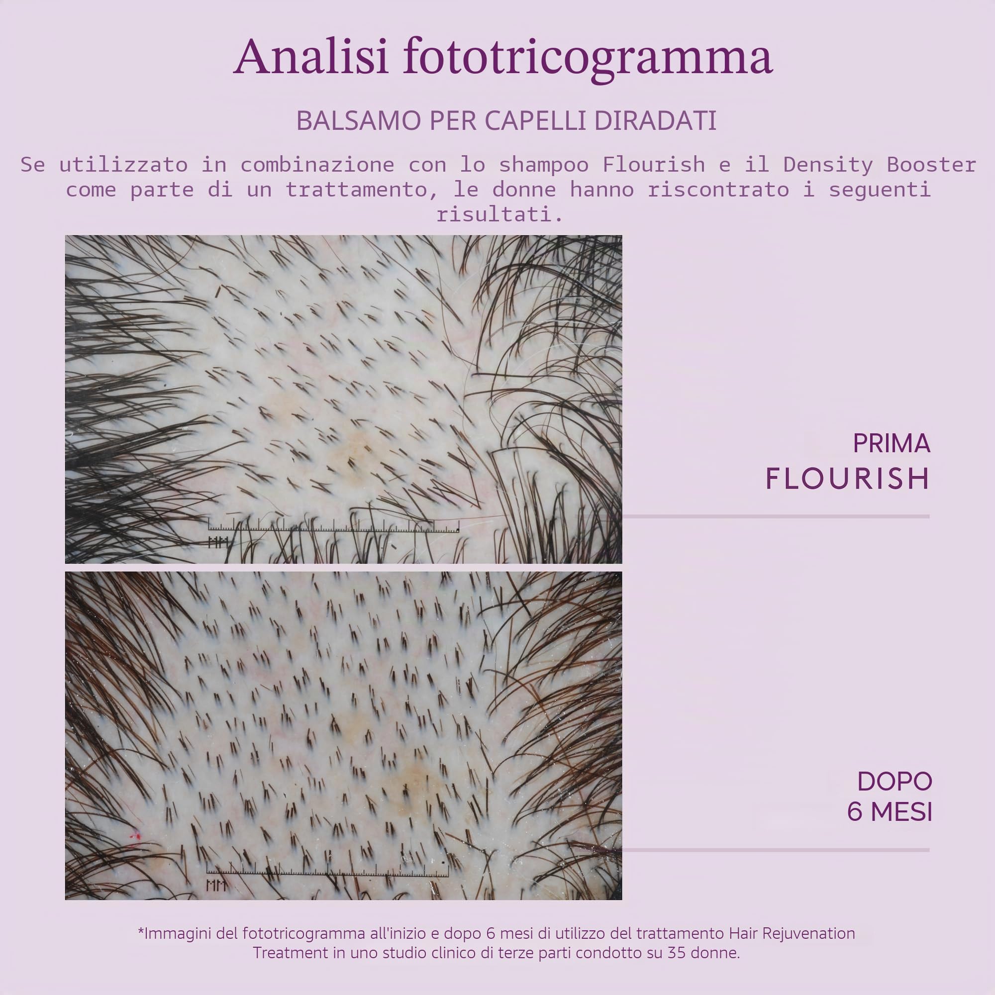 VIRTUE Balsamo Flourish per capelli che si assottigliano | Nutre, ispessisce, districa i capelli che si assottigliano