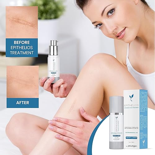Miniatura 3 de Epithelios Tratamiento avanzado de cicatrices sin SPF – Compatible con maquillaje y cremas, gel de silicona autoadherente para cicatrices –