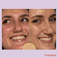 Vista 6 de Tower 28 Beauty SunnyDays - Protector solar teñido SPF 30 para pieles sensibles, 2 en 1, protección facial de amplio espectro UVA/UVB + base, tono