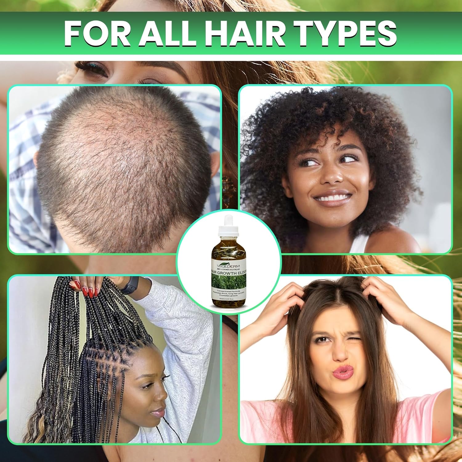 Hair Growth Elixir | Natural Hair Growth Oil for Scalp & Beard | Hair fall control Serum for Women & Men | Rosemary, Castor Oil, Biotin | Treatment for Longer Hair & Beard | 4.05 Fl Oz - Image 5