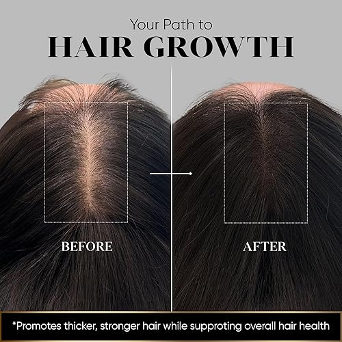 Miniatura 6 de Vita Suplemento para el crecimiento y la pérdida del cabello (fórmula micronizada) - 100% natural para un cabello más saludable - Apoya el