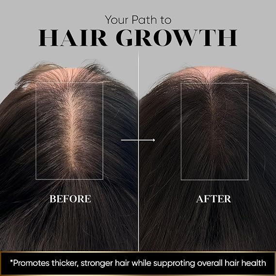 Vita Hair Micronized Formula - Support for Men & Women (108 Capsules)