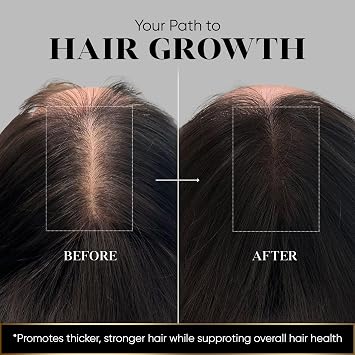 Vita Hair Micronized Formula - Support for Men & Women (108 Capsules)