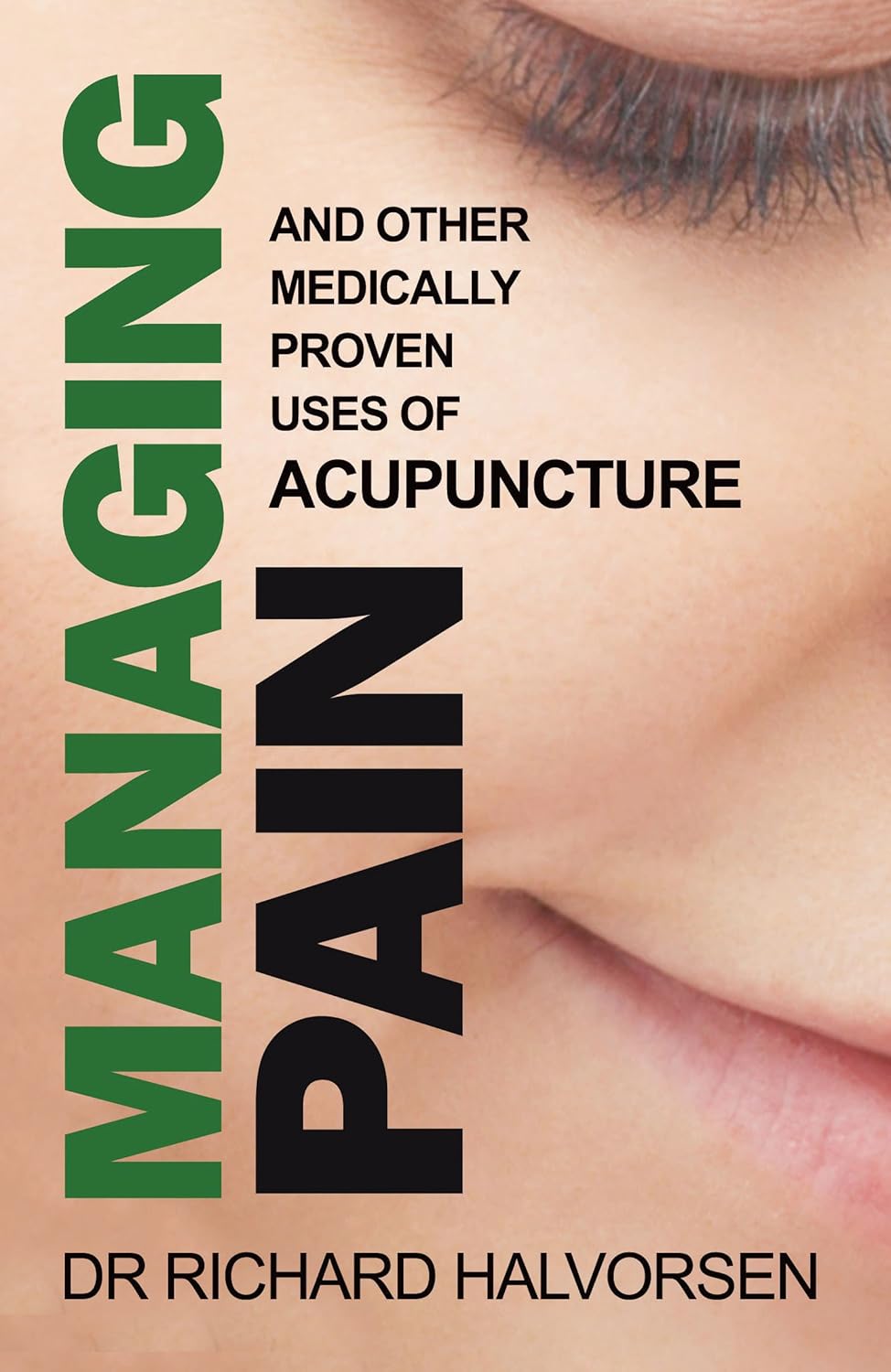 Managing Pain And Other Medically Proven Uses of Acupuncture Amazon