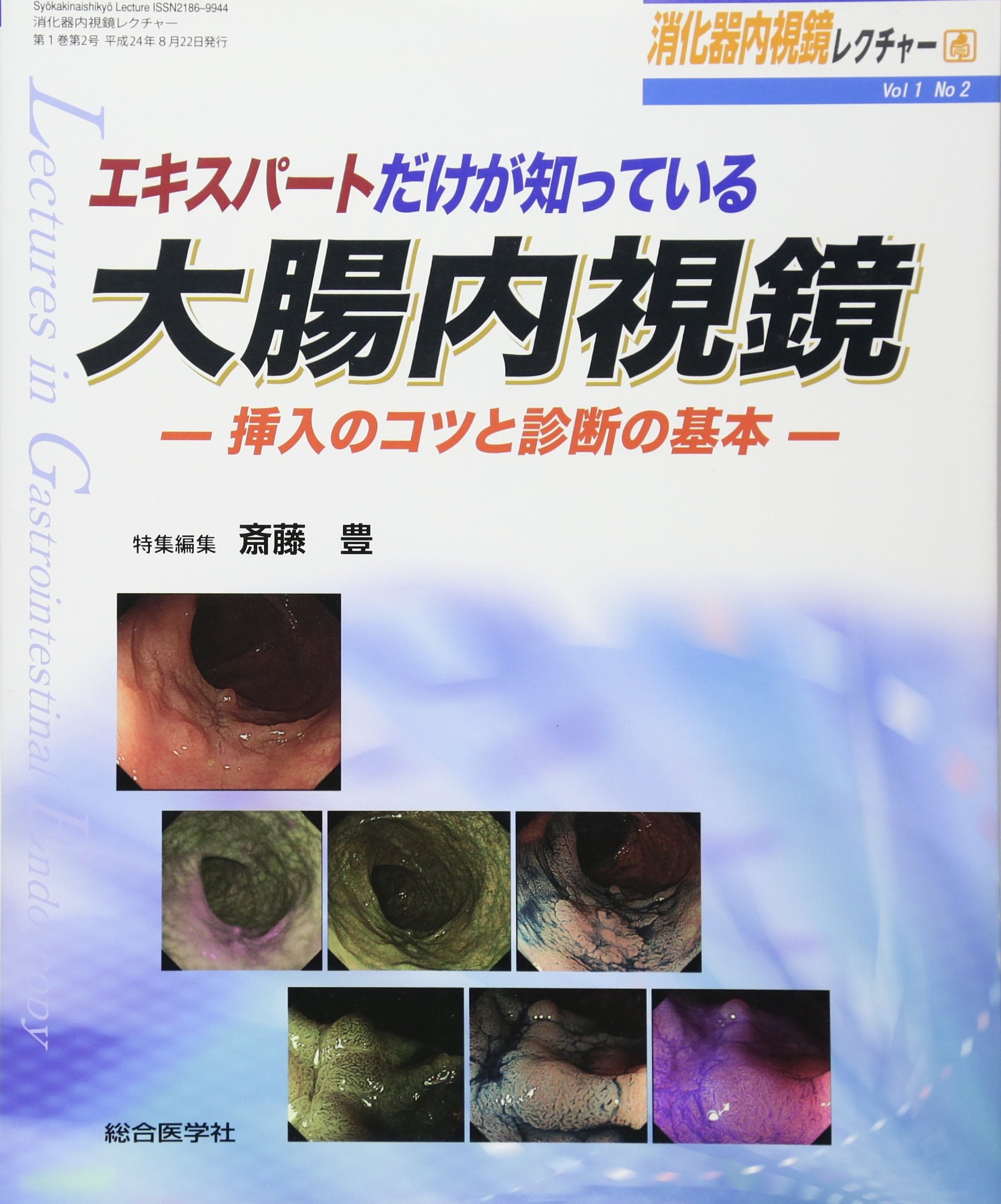 大腸内視鏡診断の基本とコツ〜エキスパートならではの見かた ○01)大腸