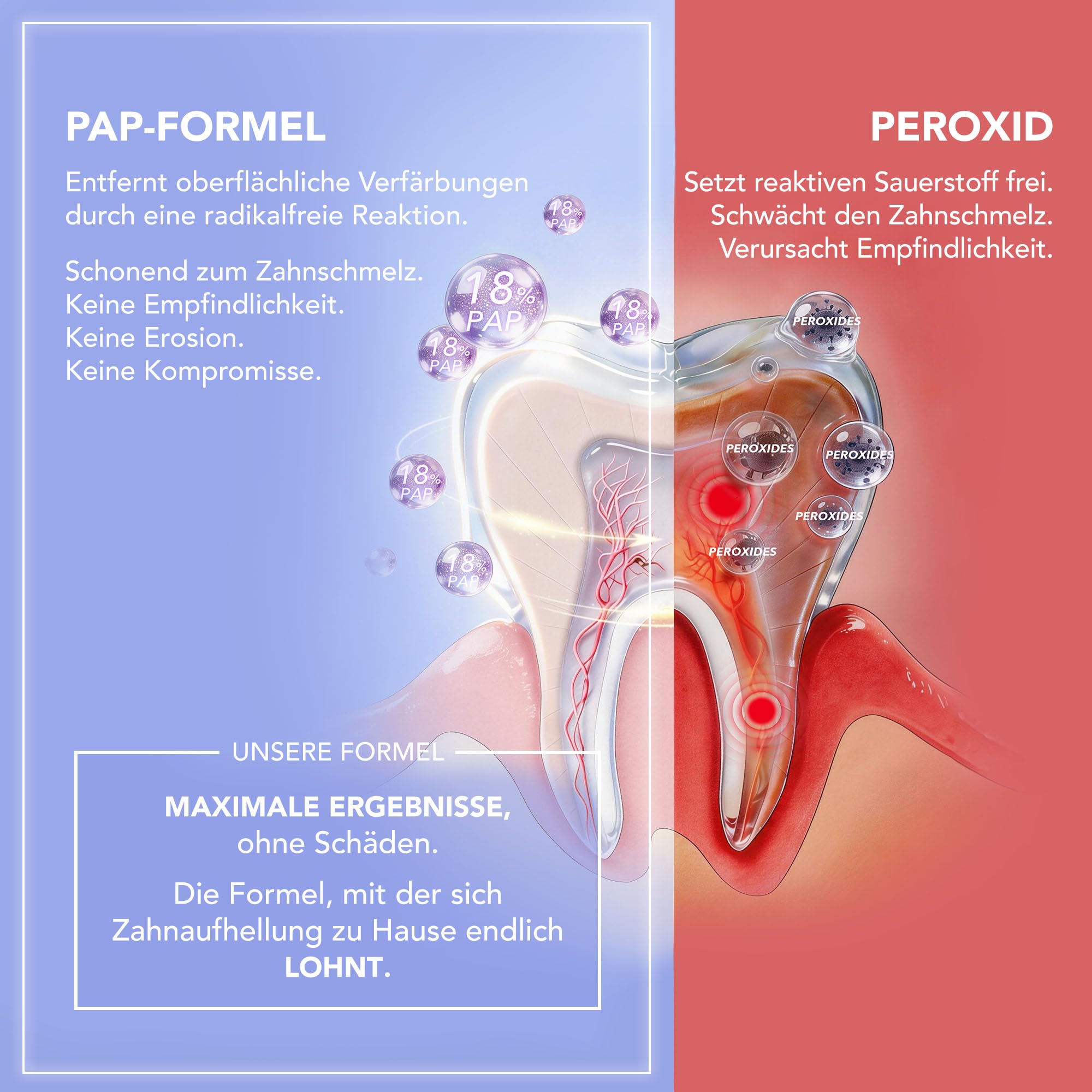 FOREO Issa Zahnaufhellungs-Set, Dual LED + Sonic-Gerät & 18% PAP-Gel