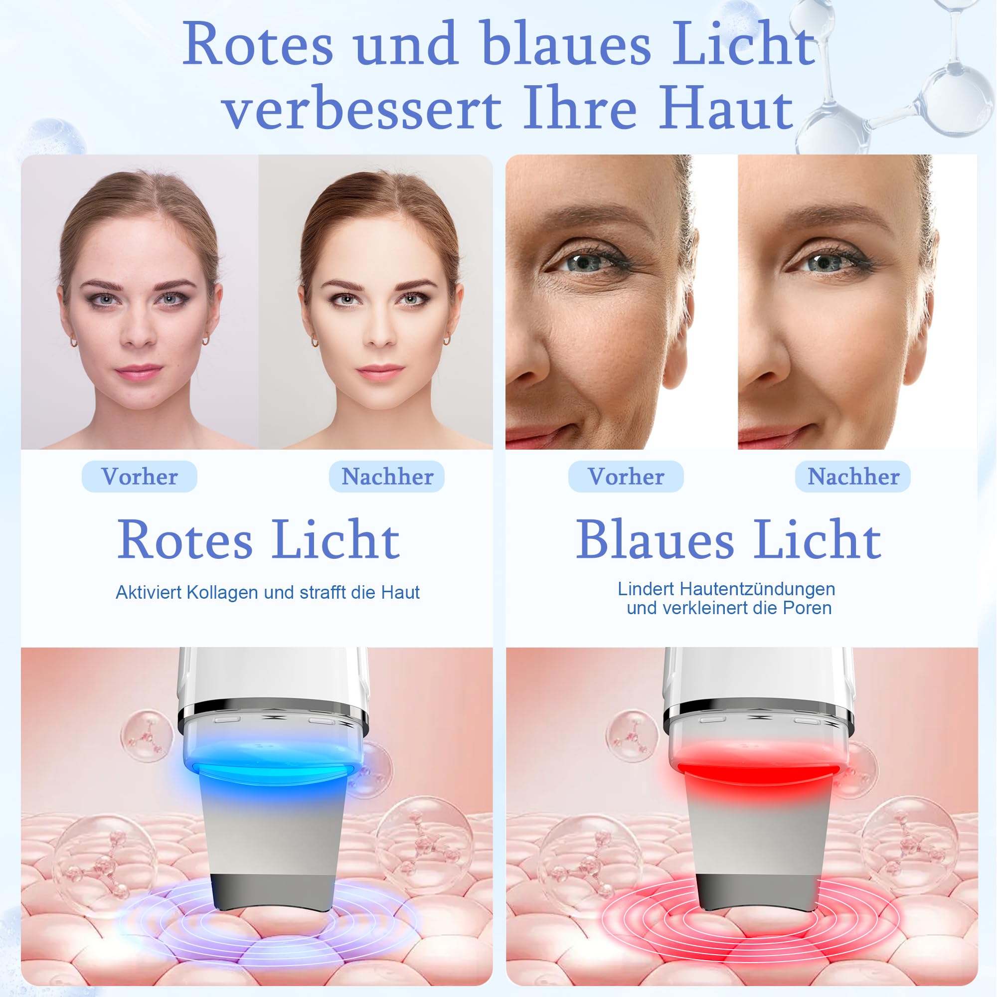 Skin Scrubber Ultraschall, Yeerain Porenreiniger Gesicht mit 4 Modi und Rotlicht Blaulicht, Mitesserentferner Ultraschallgerät für Gesichtsreinigung Gerät