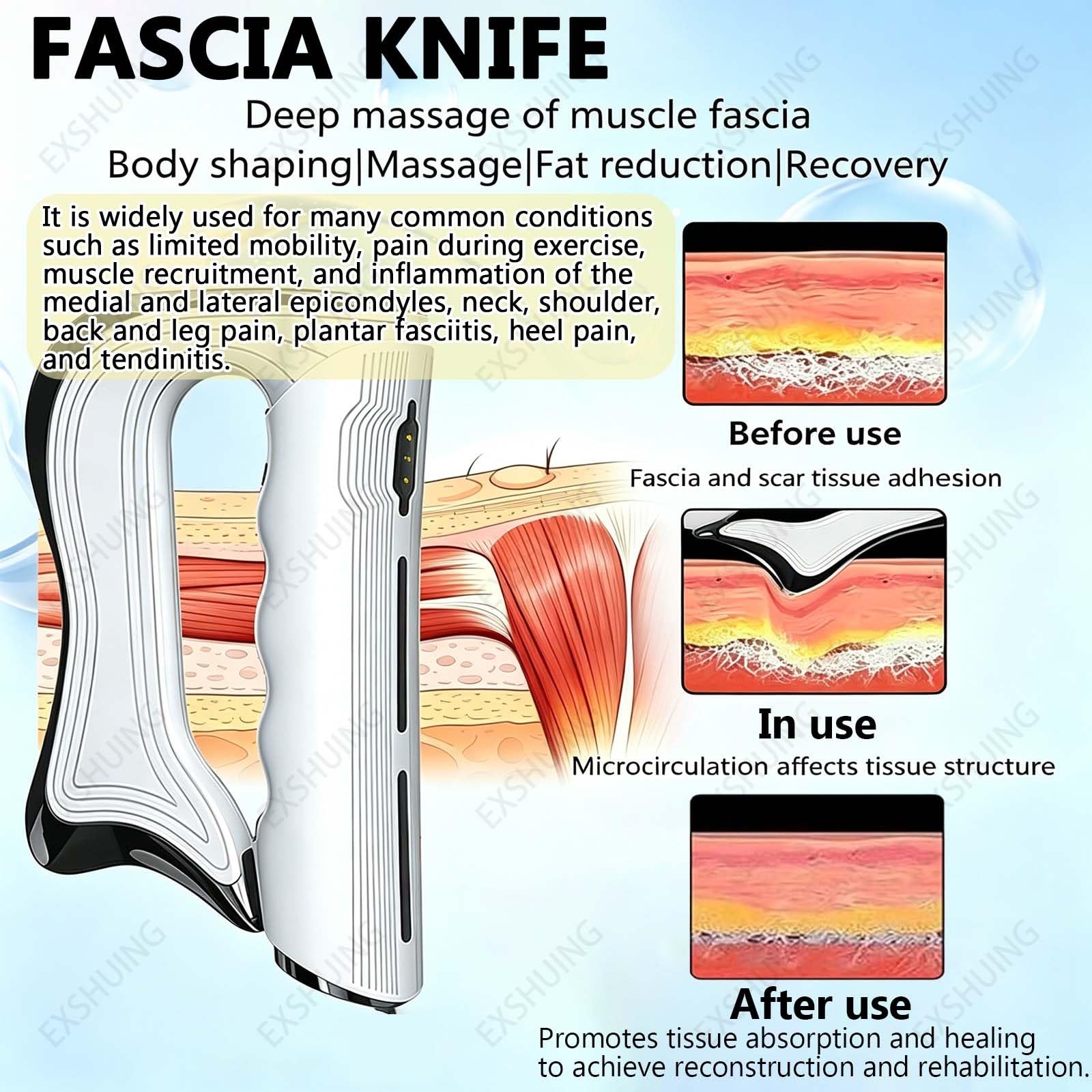 Apparecchio Per Fisioterapia Con Schermo Touch E Piastra Negativa, Diatermia Ret Cet A 448 Khz Per Sollievo Dal Dolore E Dimagrimento Di Tutto Il Corpo, 4 Cappucci + 4 Sonde Res