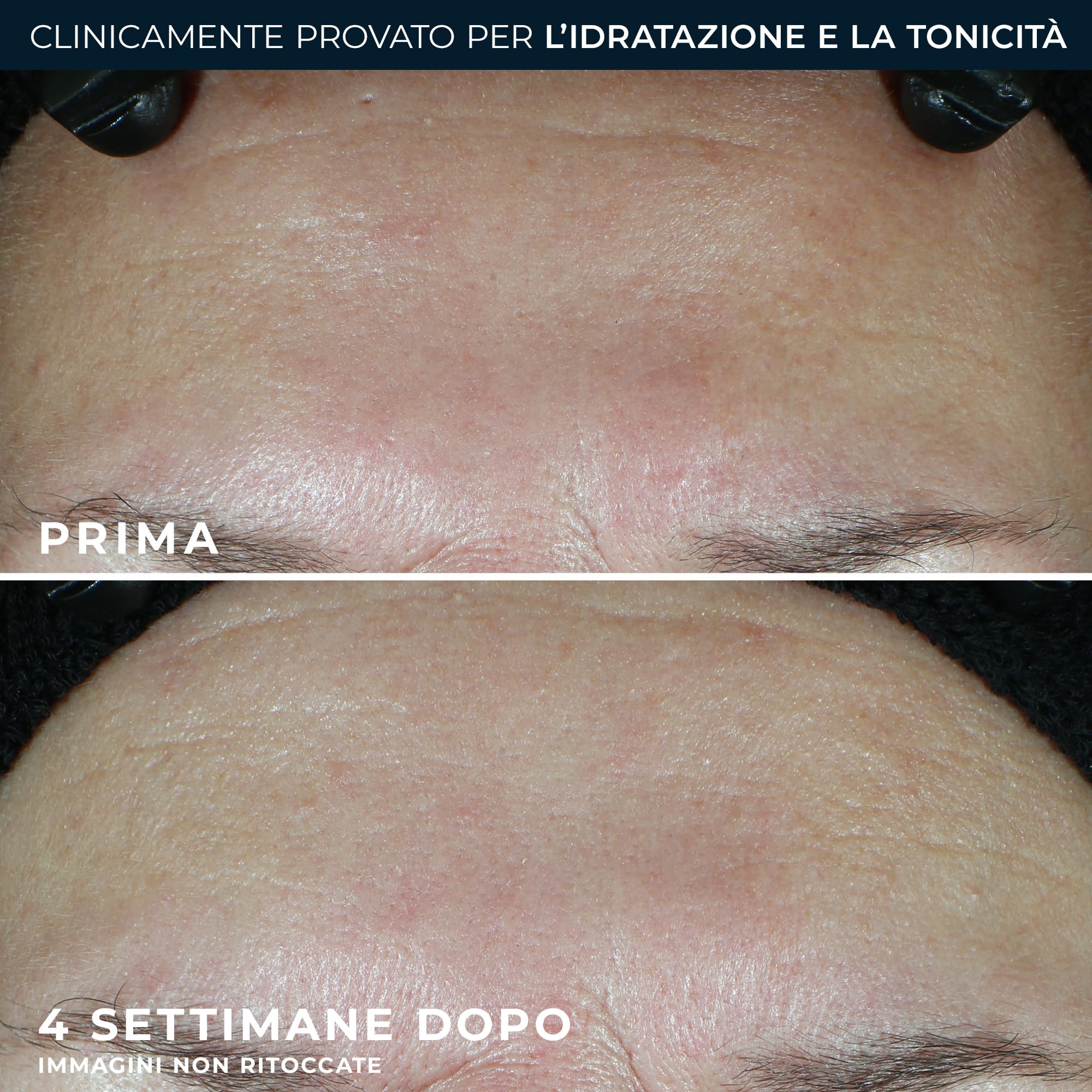 RoC - Multi Correxion Hydrate + Plump Moisturizer SPF30 - Trattamento Antirughe - Protezione Dai Raggi UVA/UVB B - 50ML