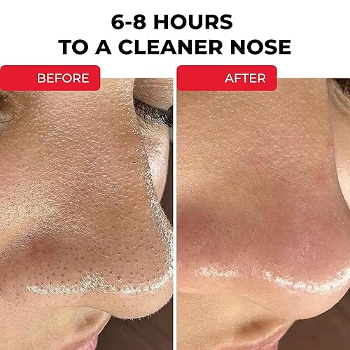 Miniatura 6 de Parches nasales HydroClear - Eliminador de acné y manchas para el cuidado de la zona T