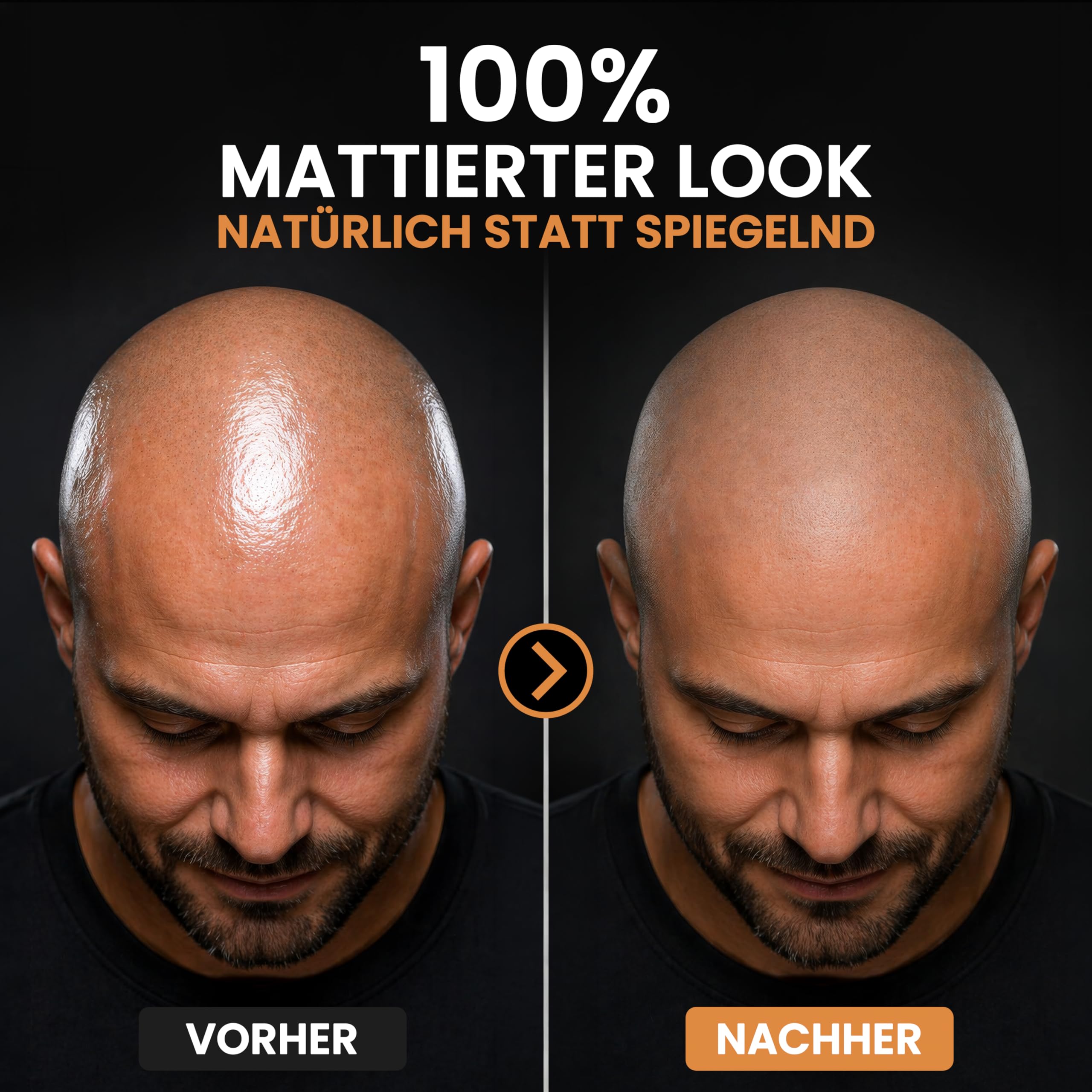 2.0 | Glatzenpflege matt | Anti-Shine | Pflegende Glatzencreme | Kopfhaut Pflege mattierend | Feuchtigkeitsspendend | Ideal bei Haarpigmentierung (SMP) | 74g
