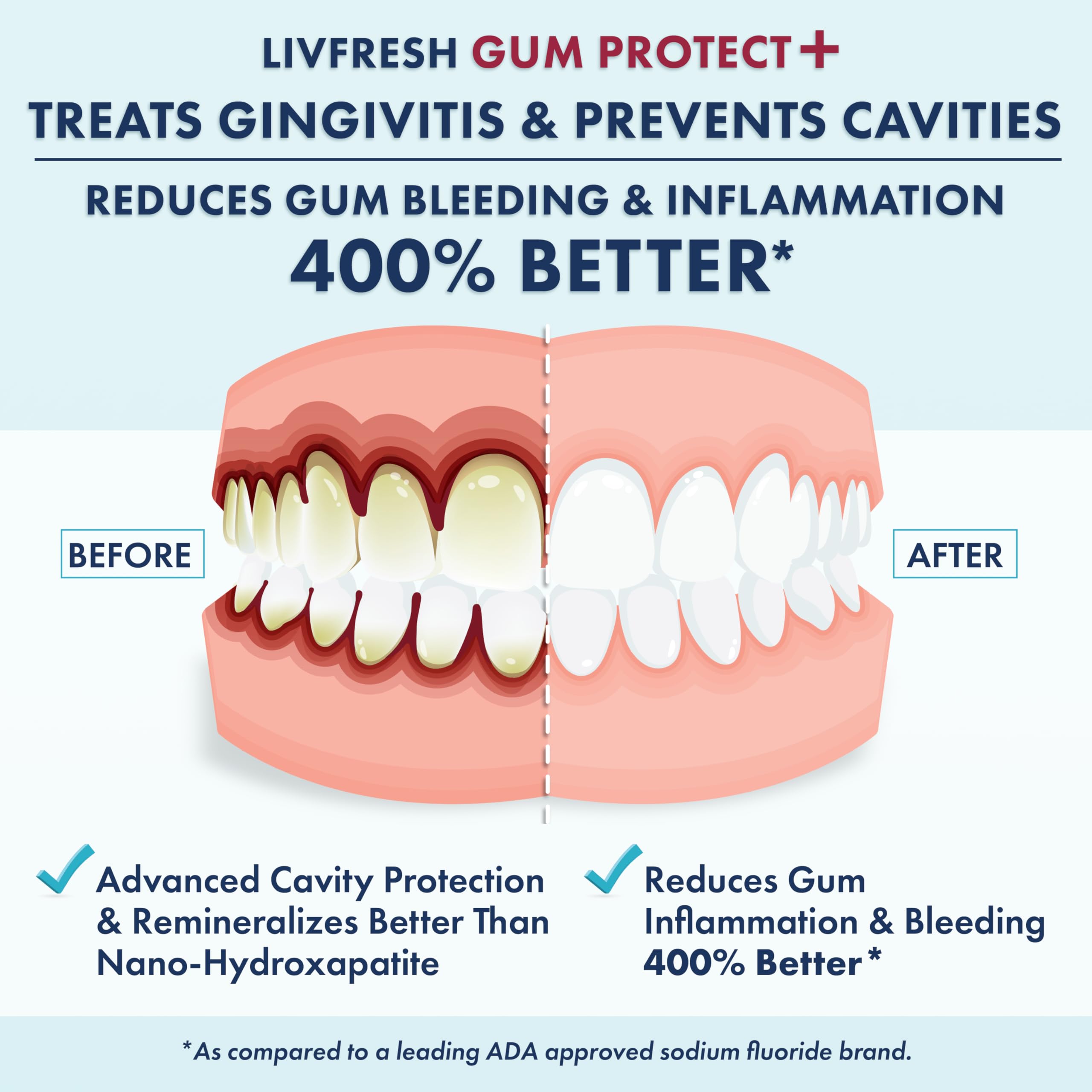 LIVFRESH Gum Protect Toothpaste Gel, Gingivitis Treatment, Reduces Bleeding, Swollen Gums 400% Better, Cavity Protection, Remineralizes Teeth, Whitens Teeth, Stannous Fluoride (1.75 Ounce (Pack of 1) - 3