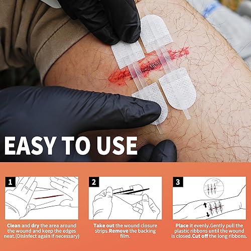 Miniatura 3 de RHINO RESCUE Dispositivo de cierre de heridas 6pcs, Tiras de cierre de heridas sin sutura para dispositivo de cuidado de cortes, vendajes adhesivos