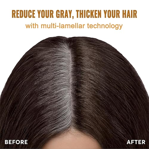 Miniatura 2 de Champú instantáneo de tinte para el cabello castaño oscuro, 3 en 1,100% cobertura de cabello gris, retoque de raíces 4 semanas, colores de champú de