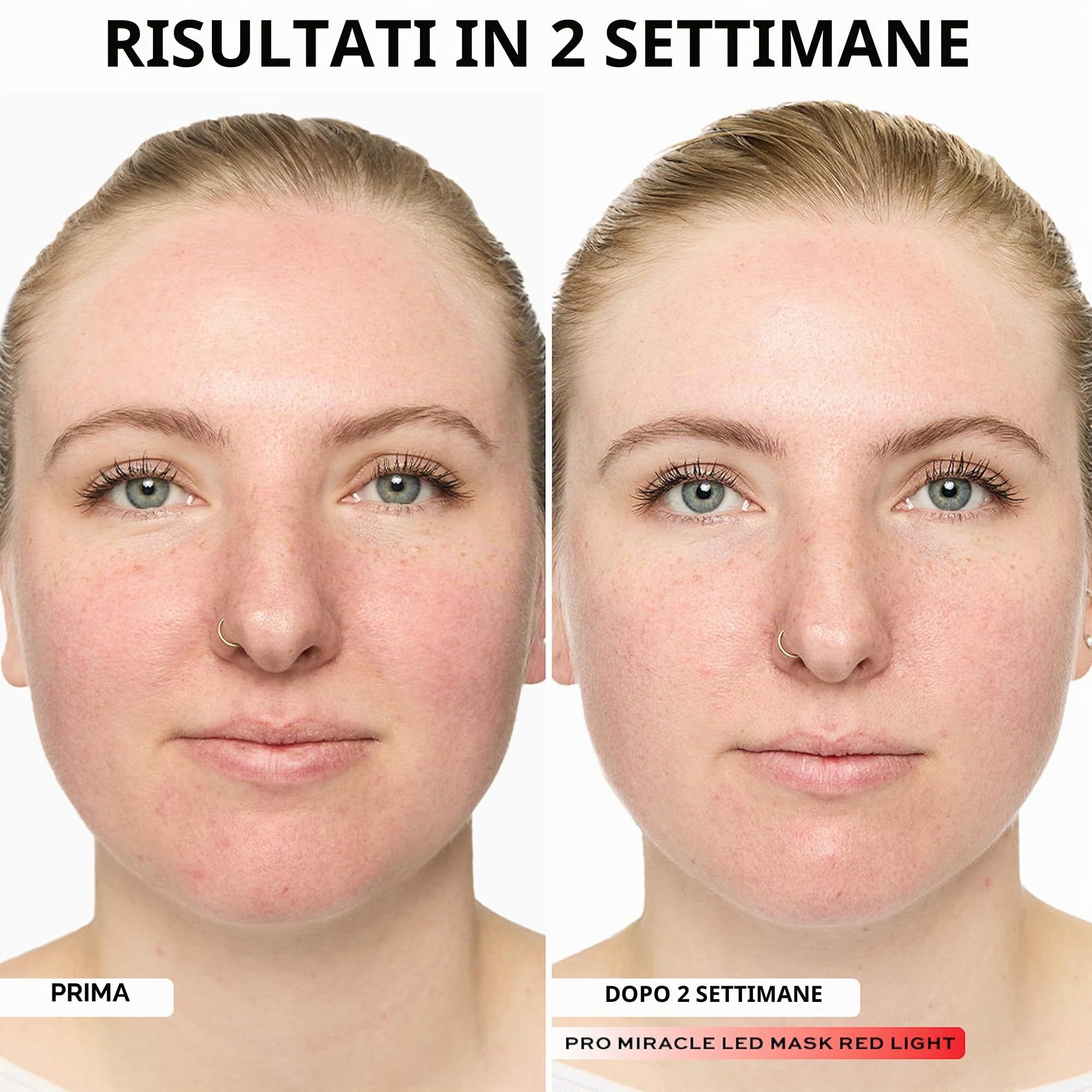Revolution Pro Miracle LED Face Mask, Maschera viso LED rosso & blu con 90 luci, migliora texture & luminosità della pelle