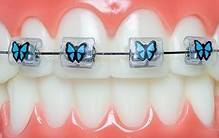 Braces Bumper Cover, Orthodontic Bracket Wax Substitute, Alternative Snap-on Braces Guard Braces Accessories 10 pack (Butterfly)