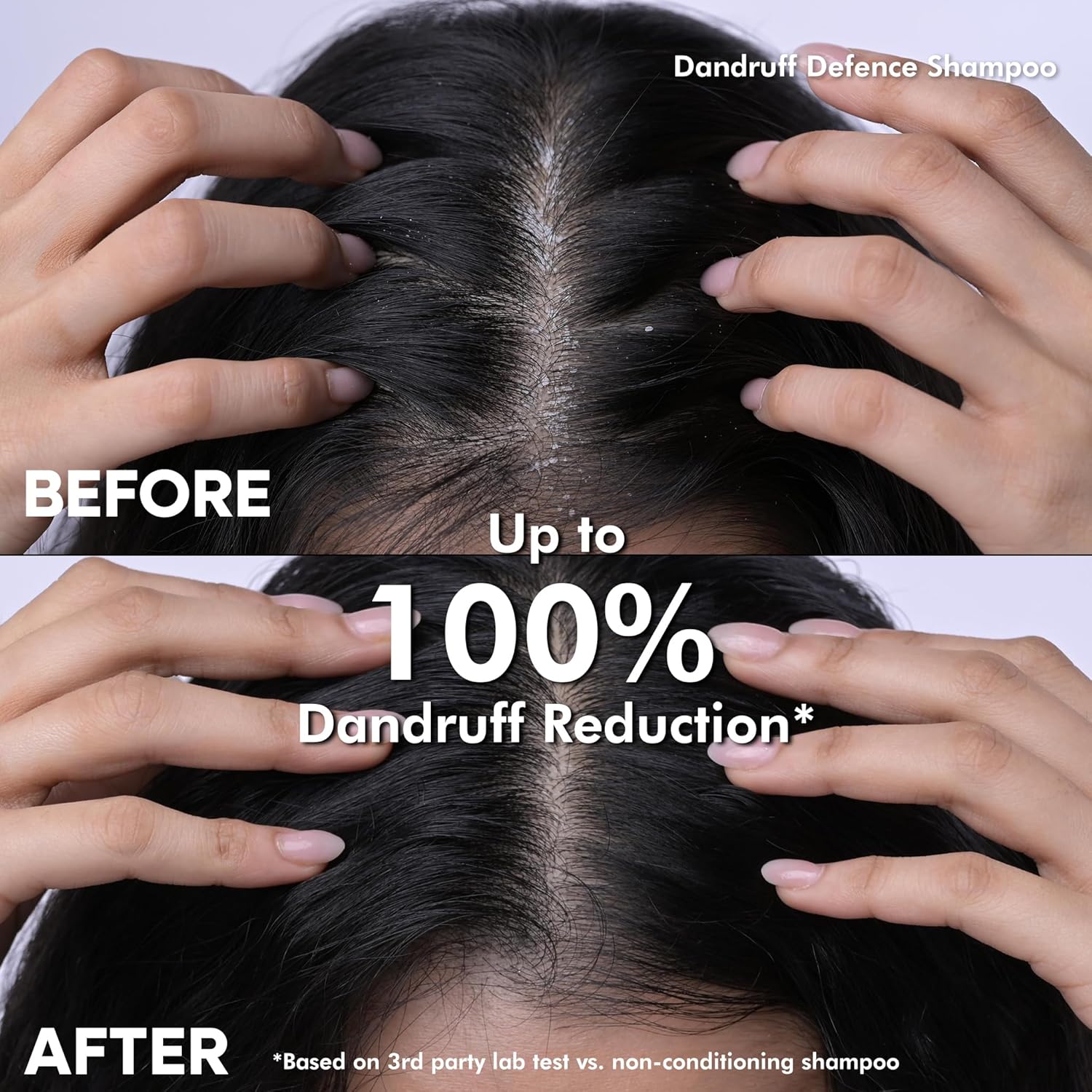 Dandruff Defence Shampoo + Hair Fall Arrest Conditioner + Daily Purifying Facewash | Controls Dandruff | Reduces Hair Breakage | Strengthens Hair | Reduces Acne/Pimples | 370ml+180ml+100ml