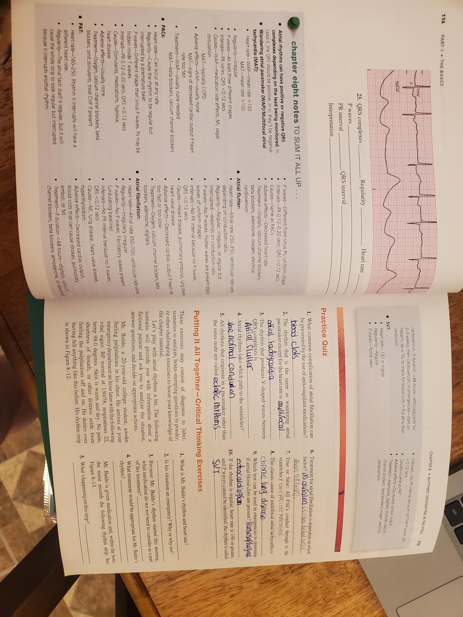 EKG Plain and Simple
