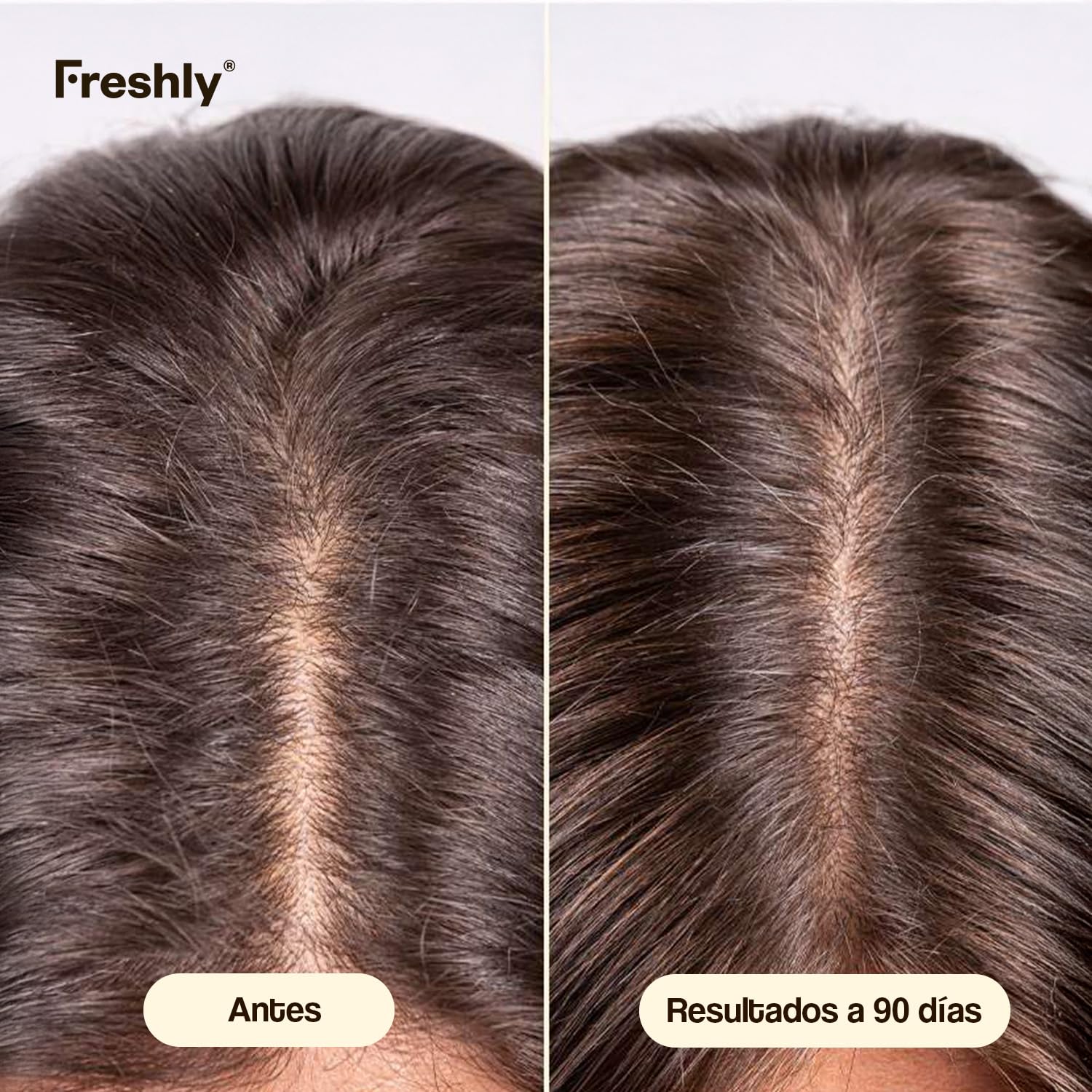 Freshly - Tratamiento Serum Capilar Anticaída del Pelo Hair Growth & Density Treatment - Fórmula 99,9% Natural - Para el Crecimiento y Densidad del Cabello - Pelo Fuerte y Saludable - 50 ml