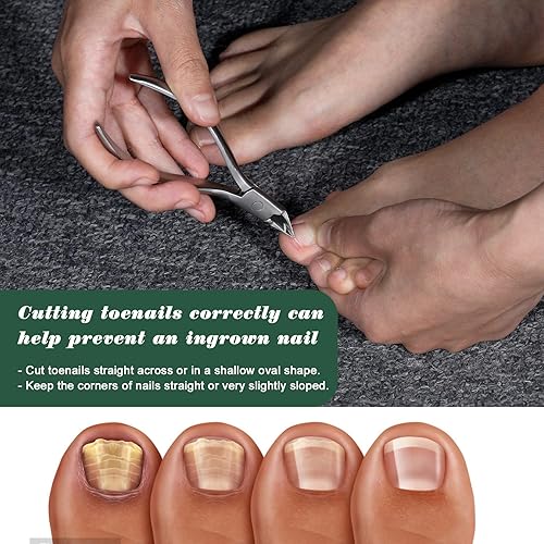 Miniatura 2 de FVION Toenail Clipper Straight Blade, Professional Toe Nail Clipper for Senior, Ingrown Toenail Tool for Thick Ingrown Nails