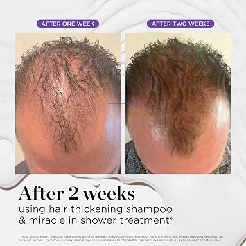 Dr. Groot Scalp Revitalizing Solution Travel Set for Hair Loss, Korean Hair Care, Hair Thickening Shampoo & Miracle in Shower Treatment, TSA Approved, 5 Seconds to Smooth Hair, Rosemary Oil