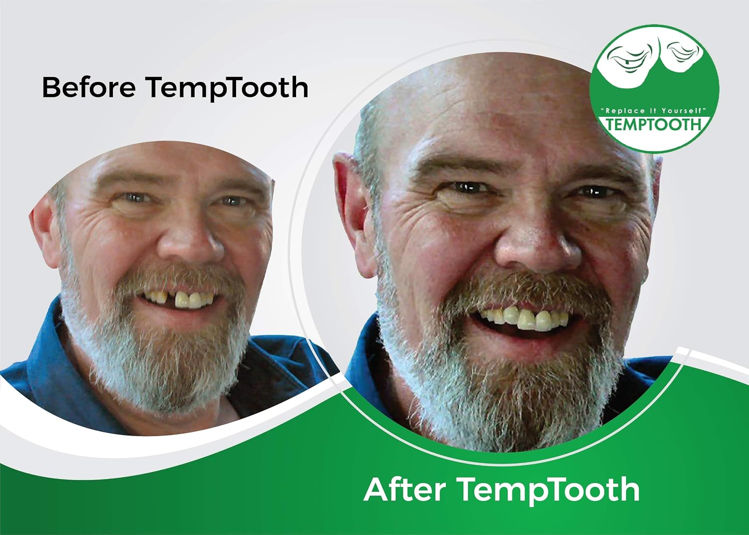 Temptooth, Temporary Tooth Replacement Kit, Replace Missing Teeth with Moldable Plastic Beads, Do It Yourself Fake Tooth, Includes Dental Tools