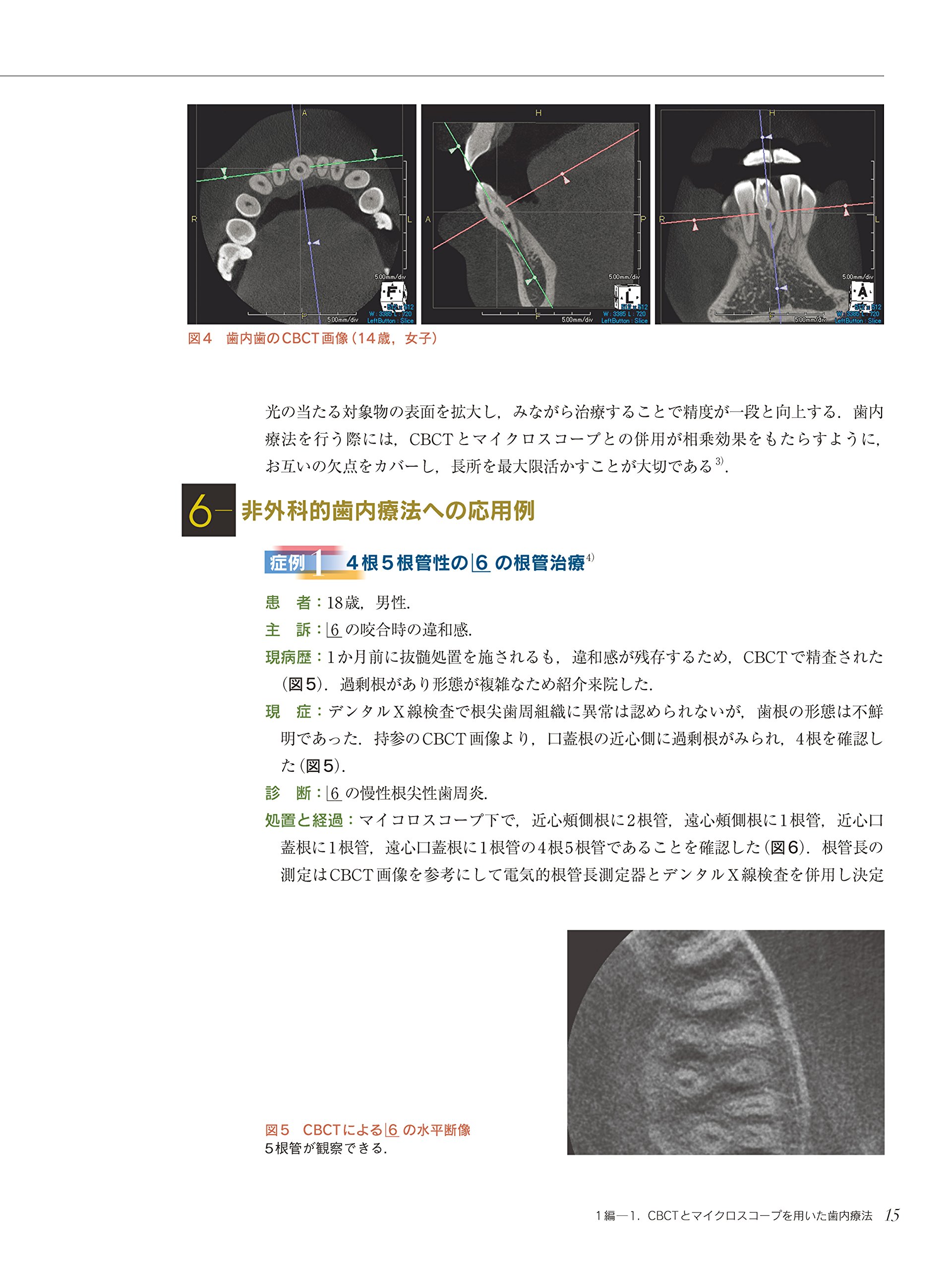 15ステップで使いこなそう 歯科用CTの完全活用 画像診断体験 嘉則