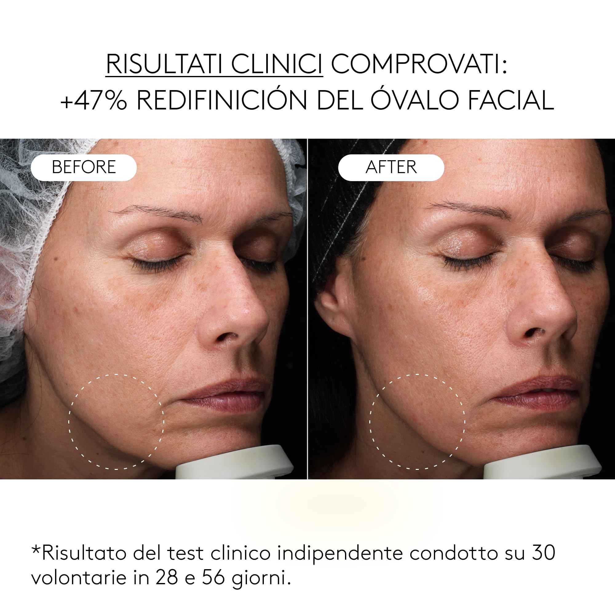 COCUNAT Clinical Exosomes Siero Viso Antirughe Esosomi V-Lifting 30 ml | Siero antietà ad azione rassodante. Elimina le rughe, restituisce elasticità e ridefinisce l'ovale del viso in 8 settimane.