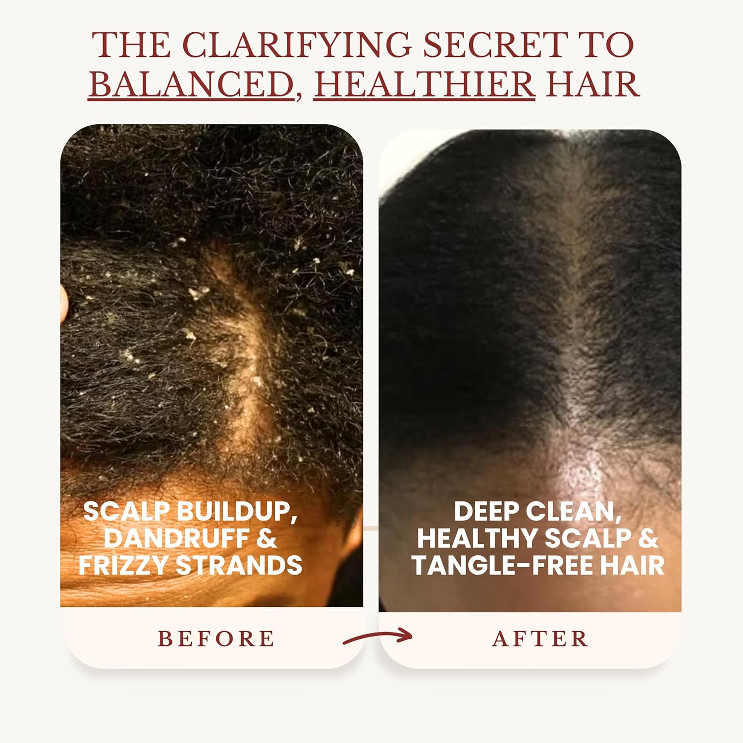 Apple Cider Vinegar Shampoo and Conditioner Set, Deep Cleans, Clarifies, Detoxes Scalp & Hair, Balances pH, Botanical, Sulfate & Paraben Free, 16 fl oz Each - Image 3