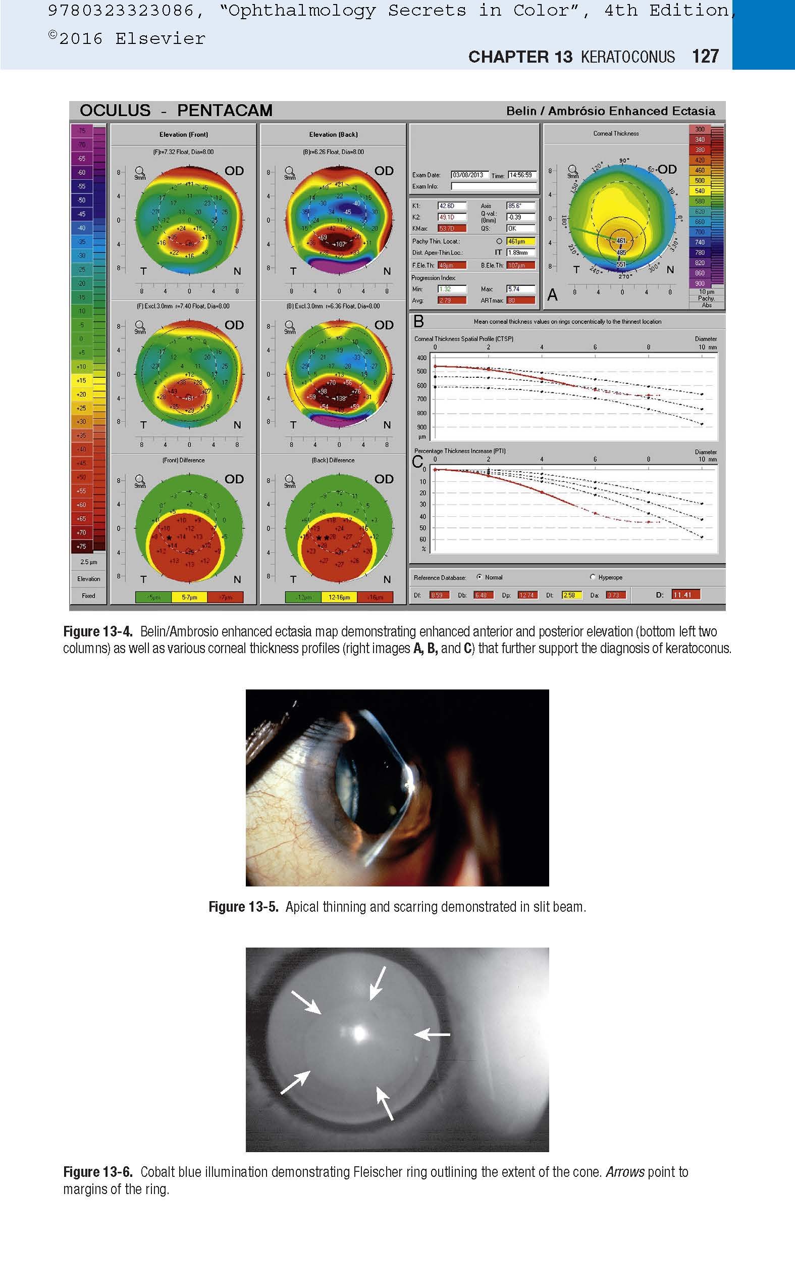 Ophthalmology Secrets in Color