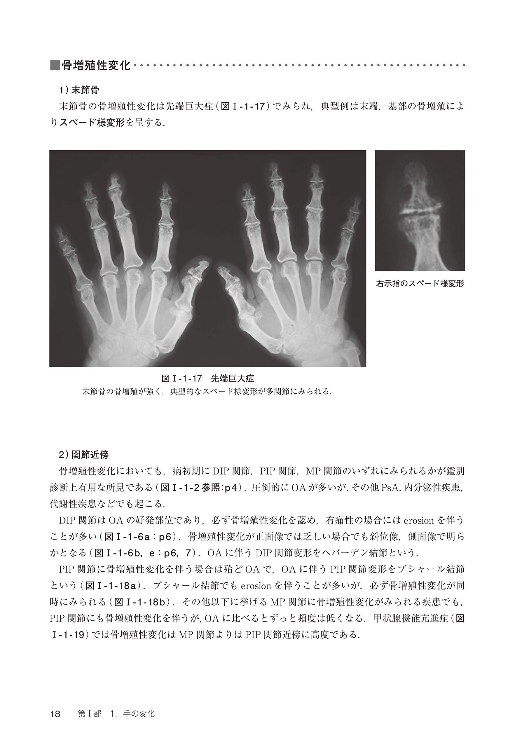 Amazon Co Jp 村田流 リウマチ性疾患の読影法 手 頚椎 腰椎 骨盤 足のxpからー 村田 紀和 Japanese Books