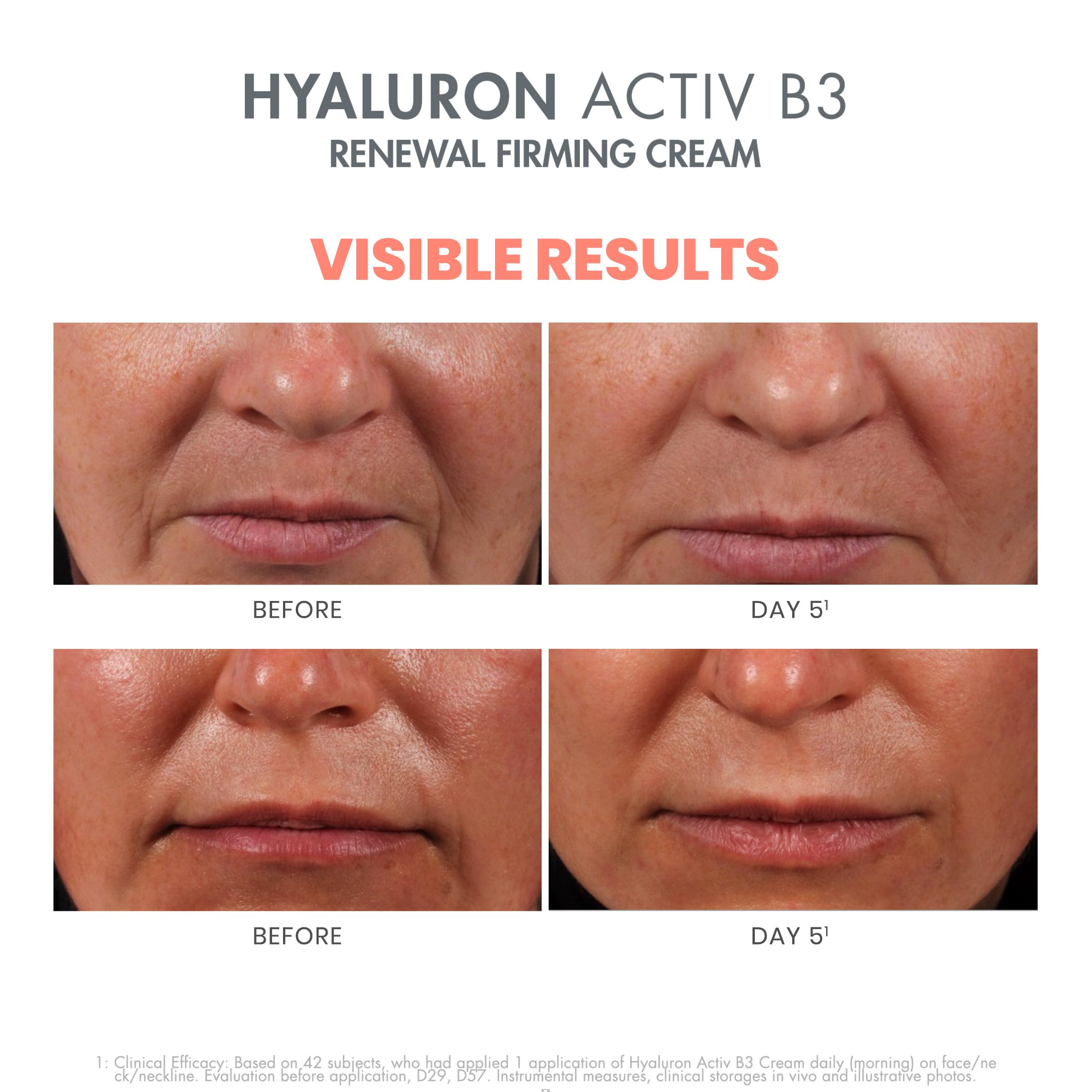 Avène Hyaluron Activ B3 Renewal Firming Cream