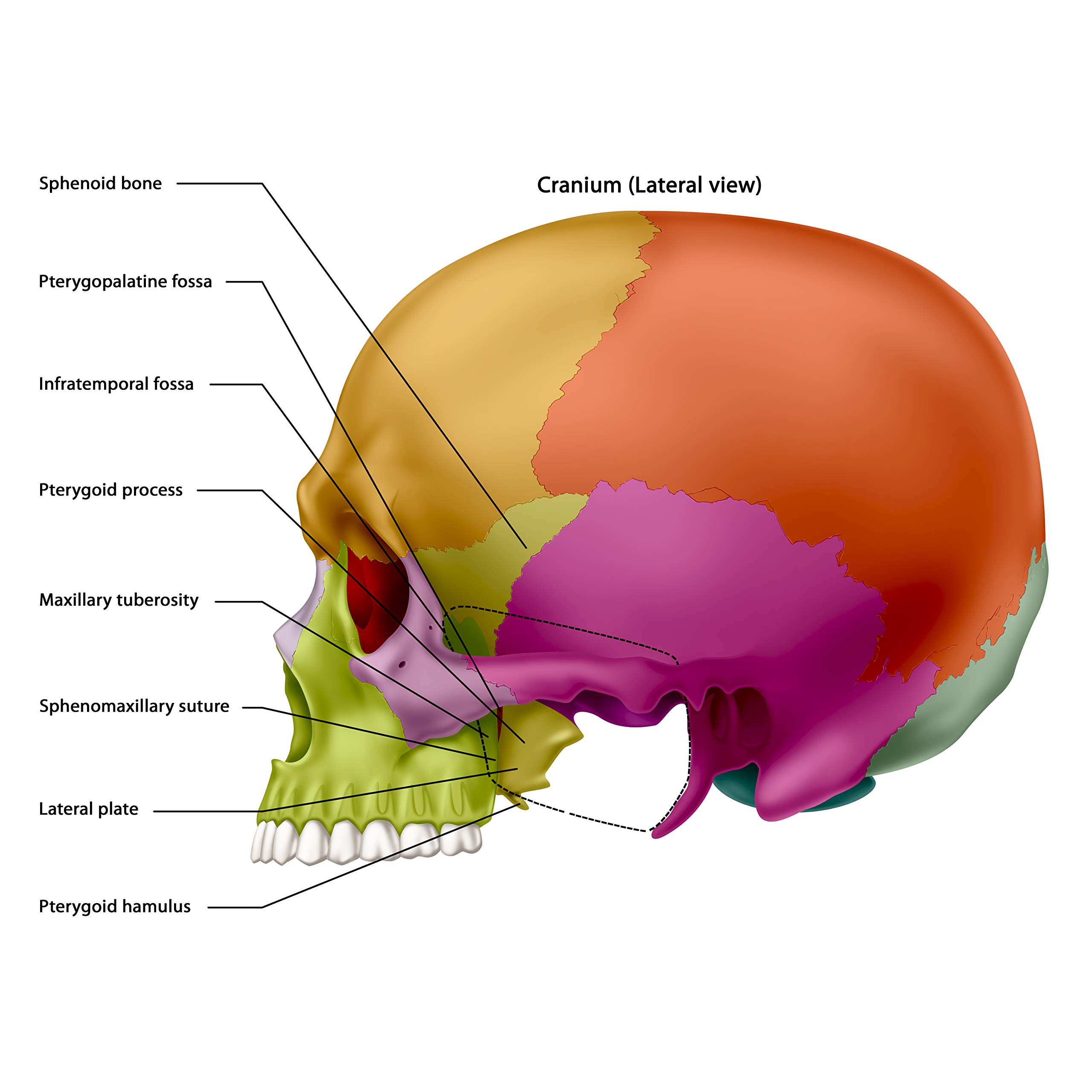 Pterygoid Implants: The Art and Science product thumbnail 6