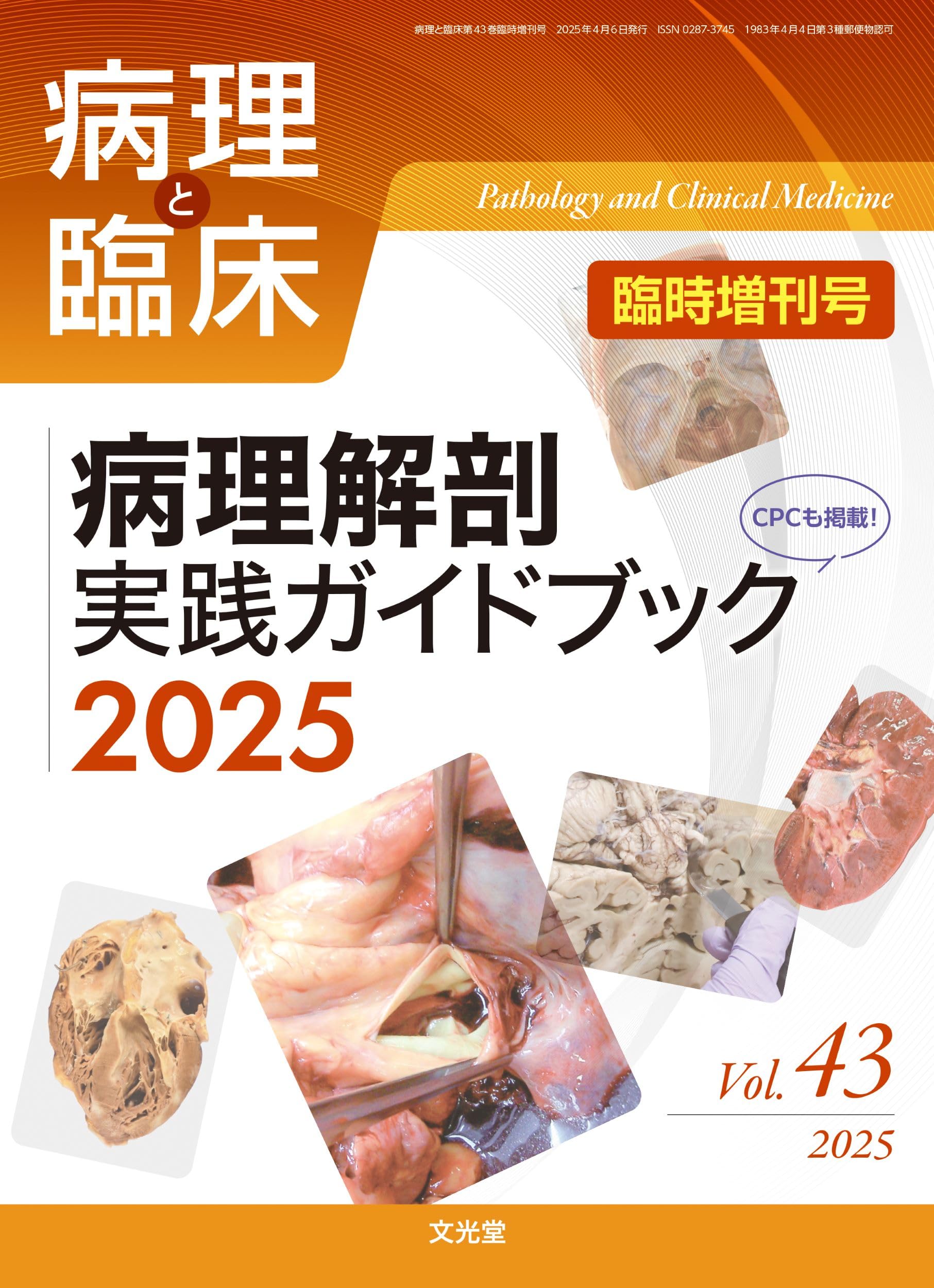 病理と臨床 2024年臨時増刊号(42巻):病理形態学キーワード2024 病理と臨床 2024年臨時増刊号(42巻):病理形態学キーワード2024