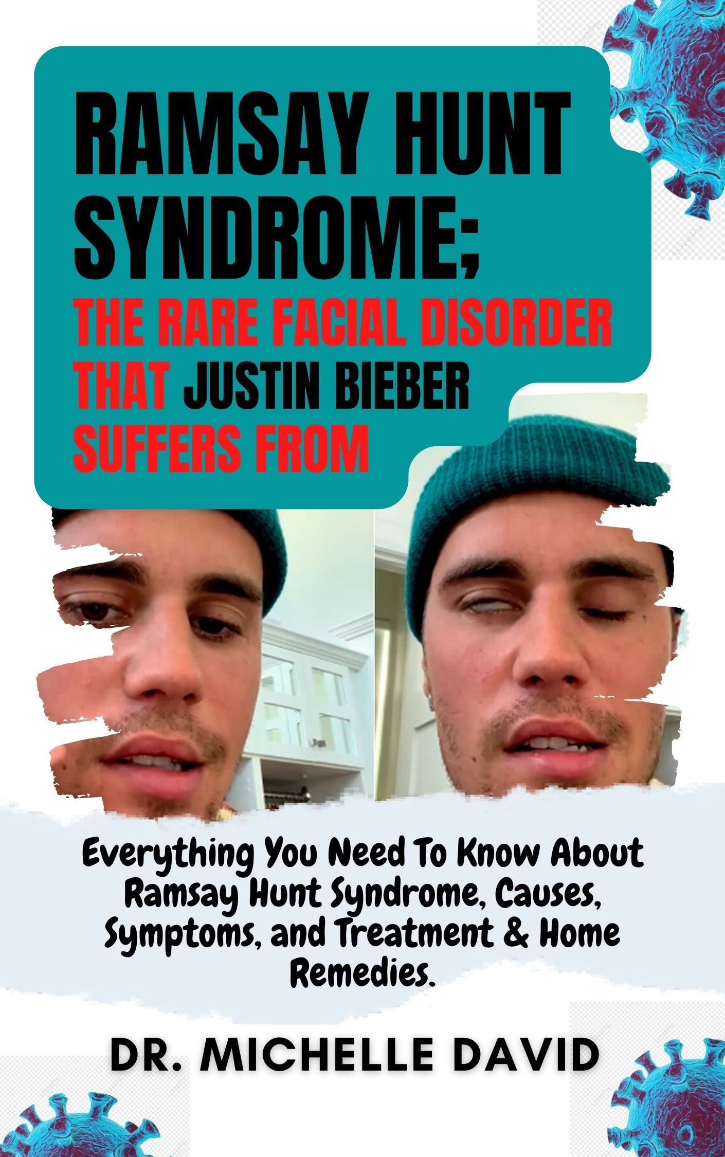 The Ultimate Guide To Shih Tzu Down Syndrome:  Everything You Need To Know - 6co7h9p