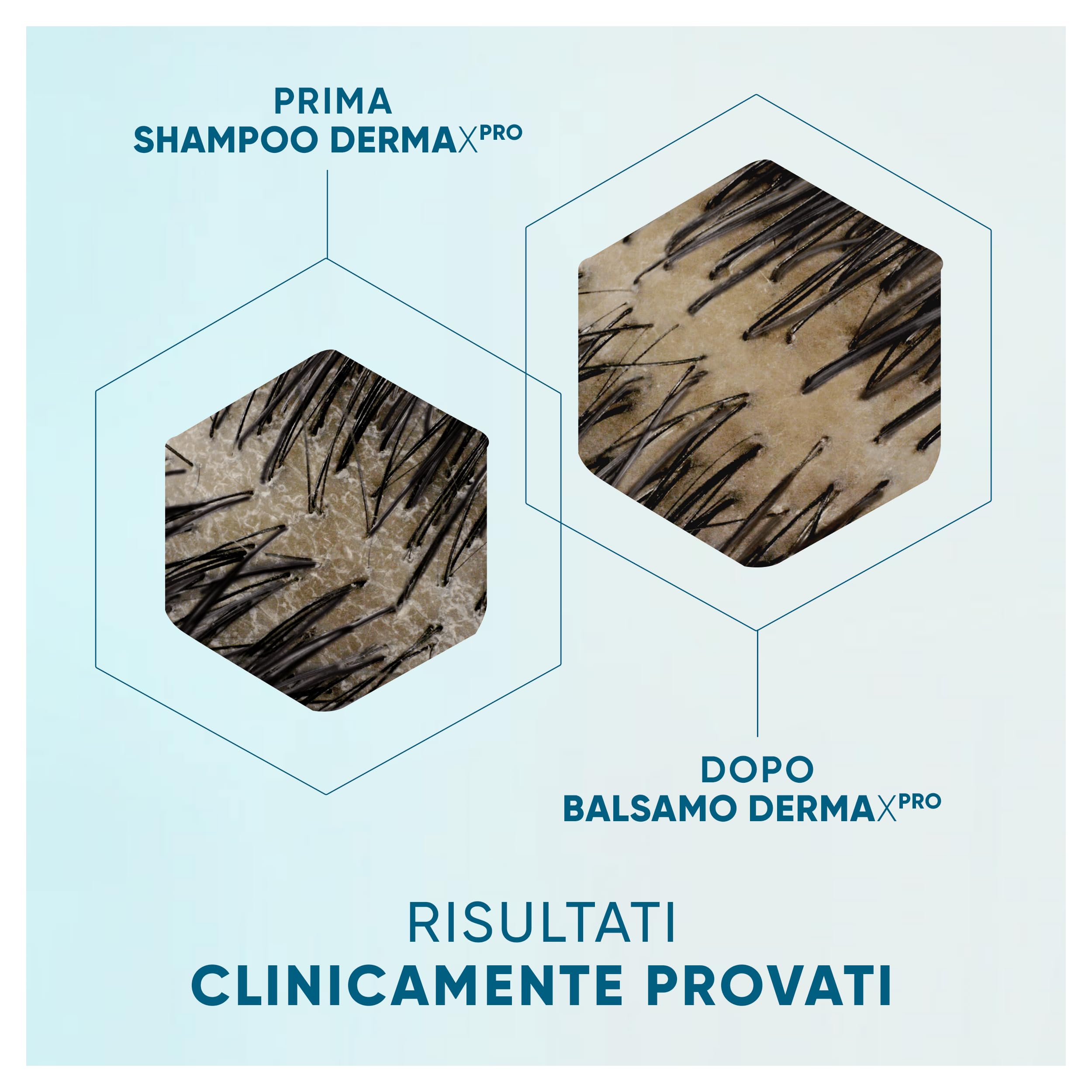 Head & Shoulders DermaXPro Shampoo Antiforfora Protezione Anti-Caduta 250ml con Caffeina e Complesso di Ceramidi Idrata Cute Secca e Capelli Fragili e Aiuta a Rinforzare la Barriera Cutanea
