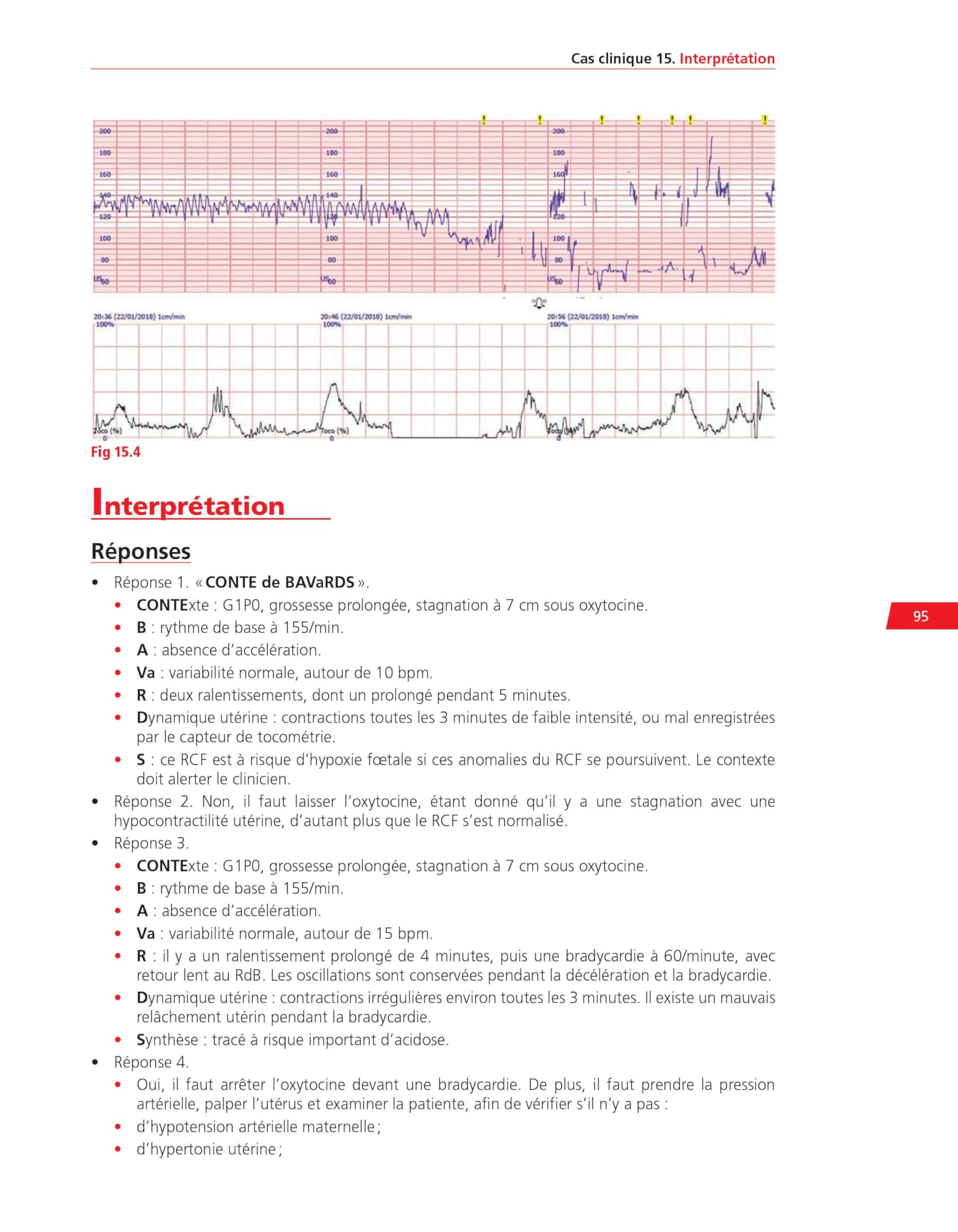 Analyse pratique du RCF : rythme cardiaque foetal: Méthodologie et cas cliniques commentés