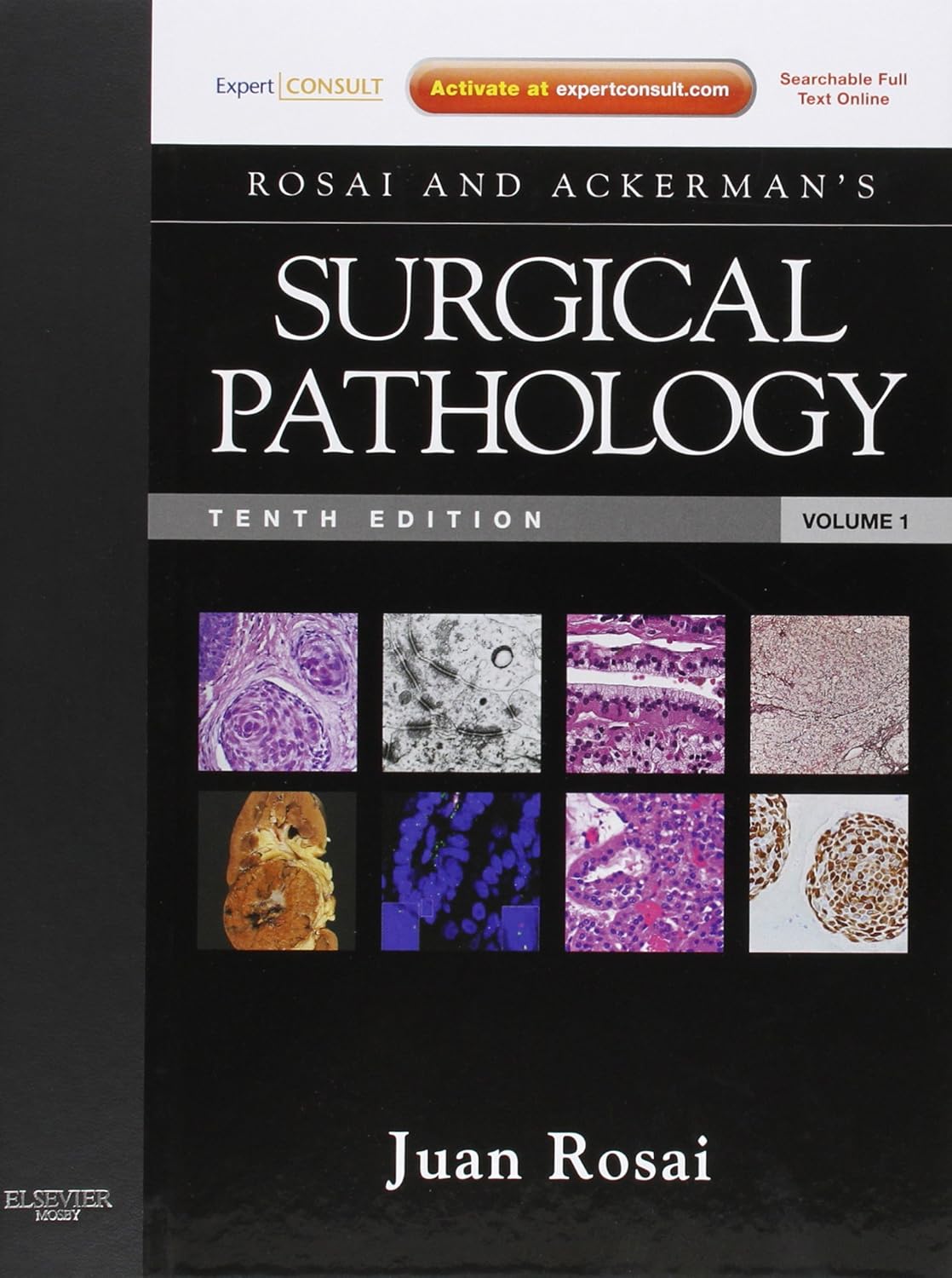 Rosai and Ackerman's Surgical Pathology: Expert Consult: Online and Print, 10e (Surgical Pathology (Ackerman's)) - 2 Volume Set