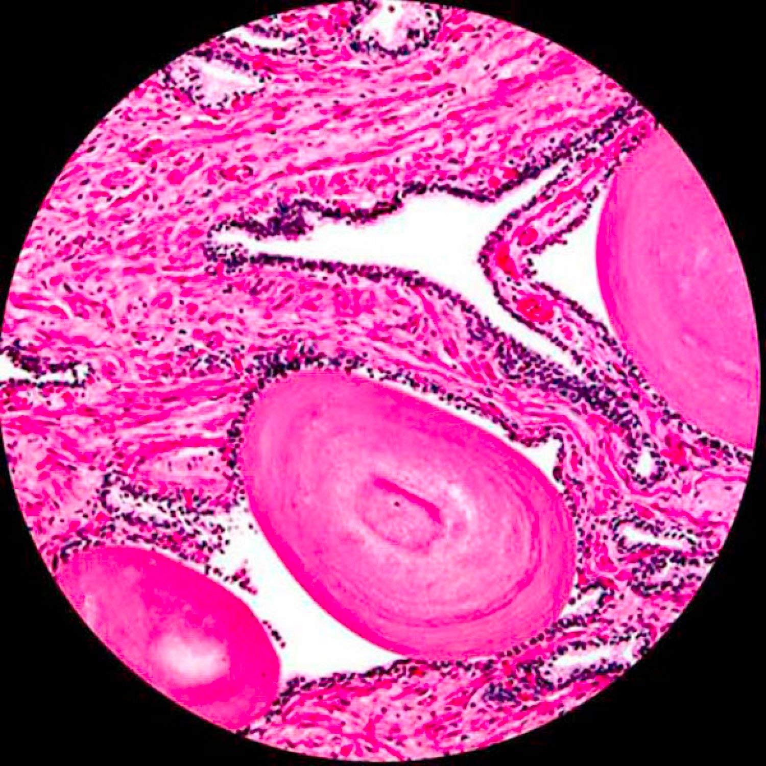 Acquista PDTO 12 vetrini preparati per microscopio, insetti